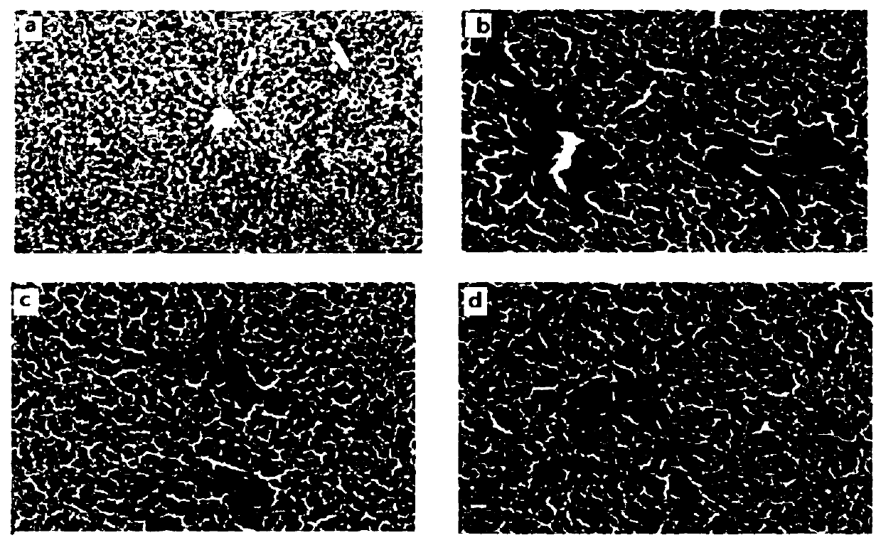 Traditional Chinese medicine composition for treatment of liver lenticular degeneration hepatic fibrosis and application