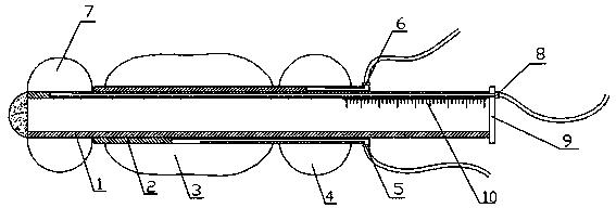 Auxiliary device used for cervical dilatation