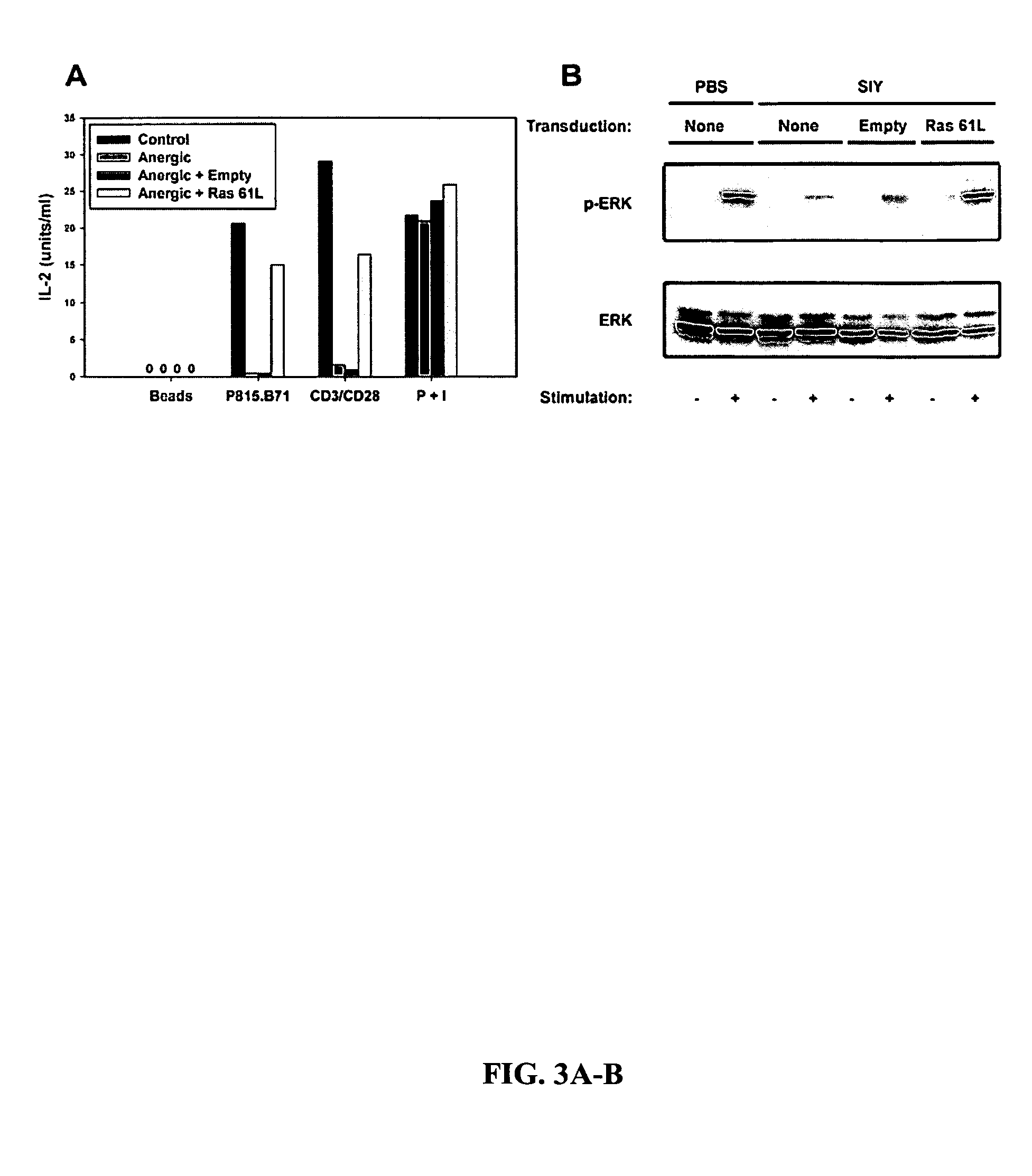 T cell anergy is reversed by active Ras and regulated by diacylglycerol kinase