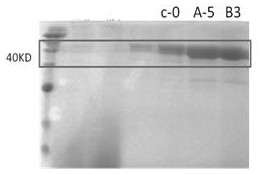 A kind of recombinant protein and its construction method and application