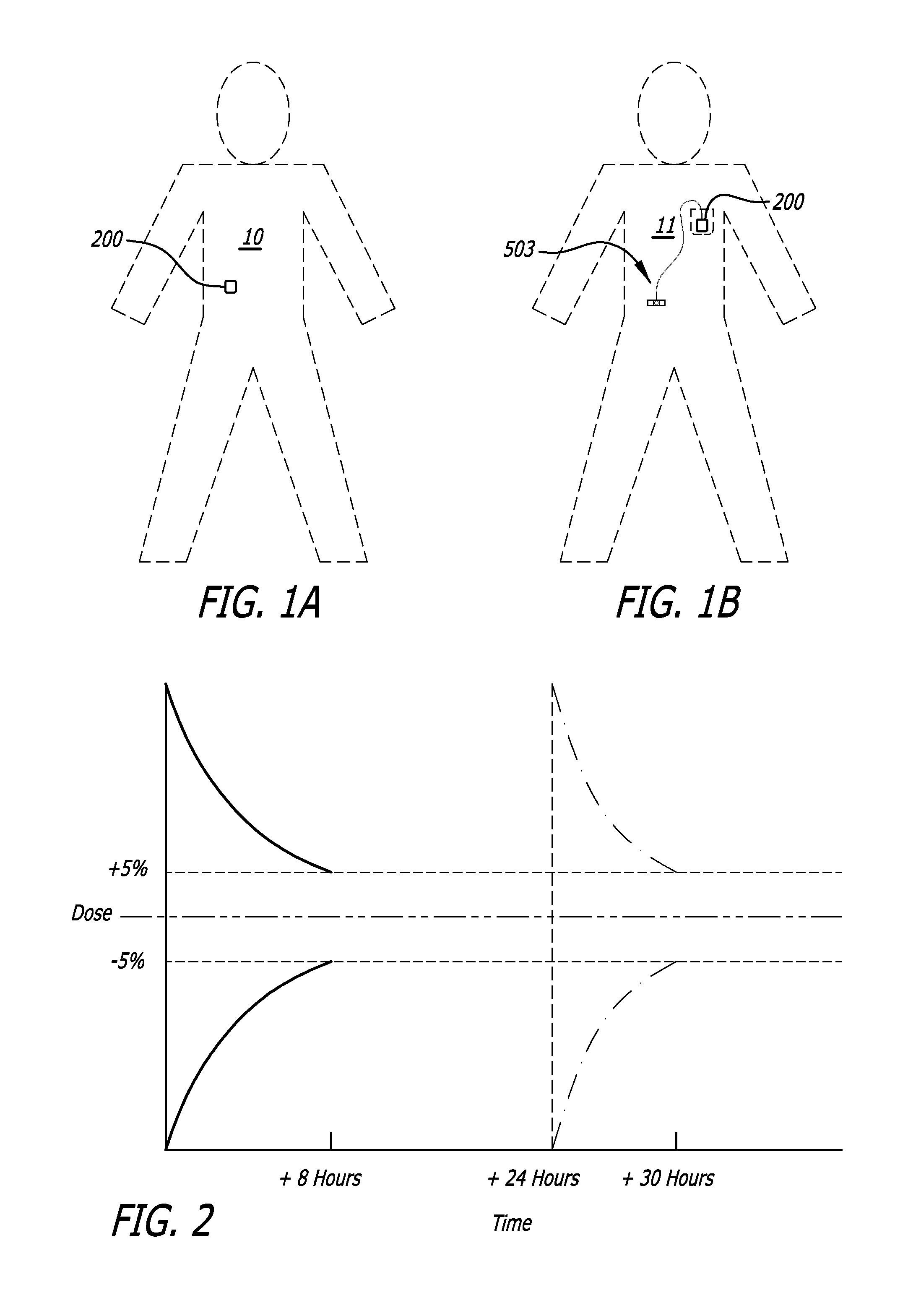 Infusion pumps