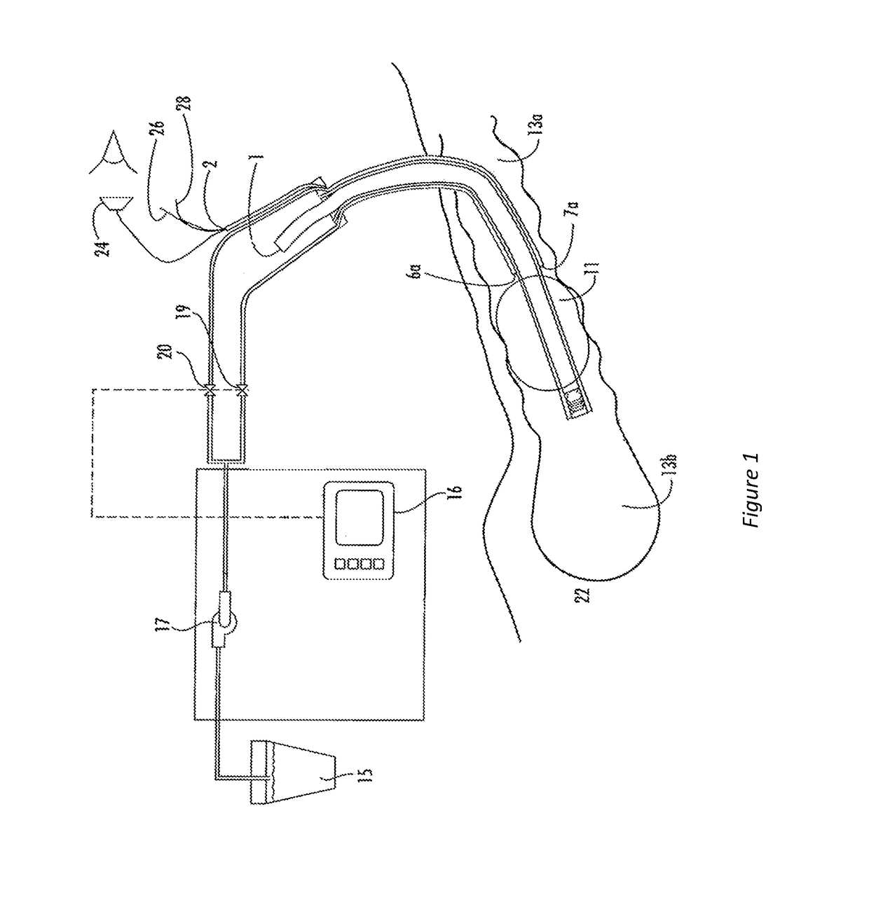 Non-invasive method of diagnosing dysphagia in patients having a tracheostomy