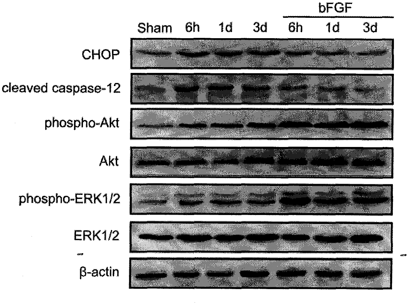 Application of bFGF (basic Fibroblast Growth Factor) to preparation of medicament for treating human ischemic stroke