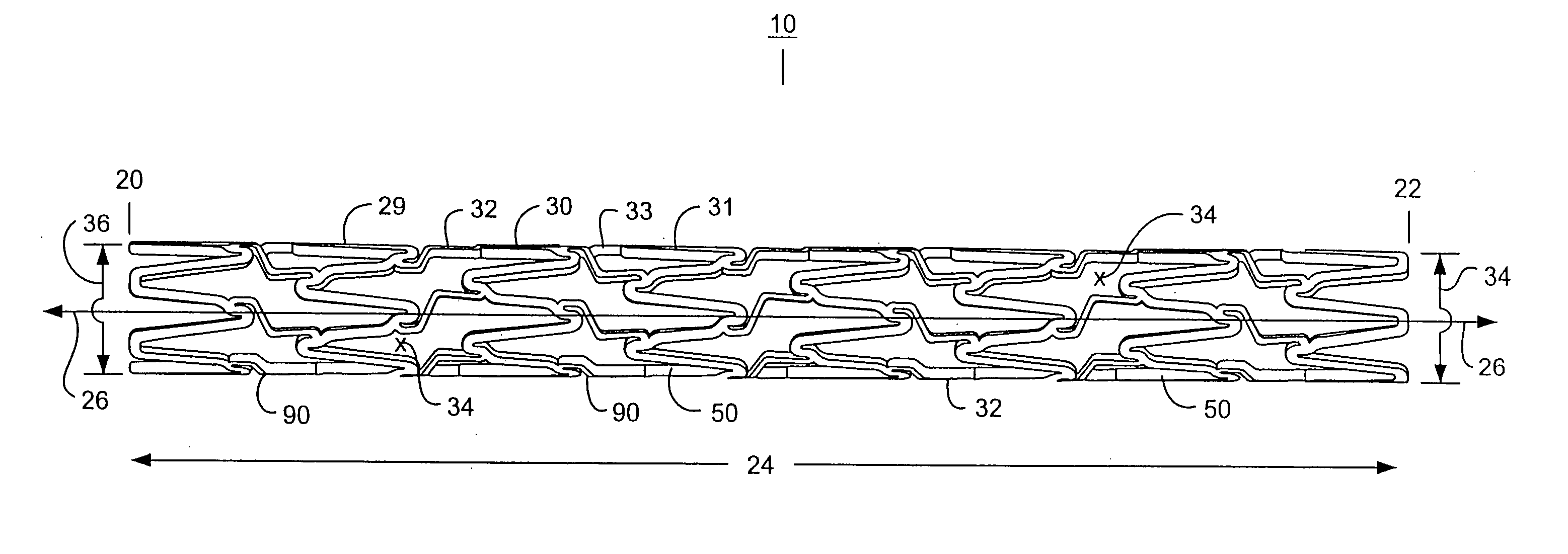 Intravascular stent and assembly