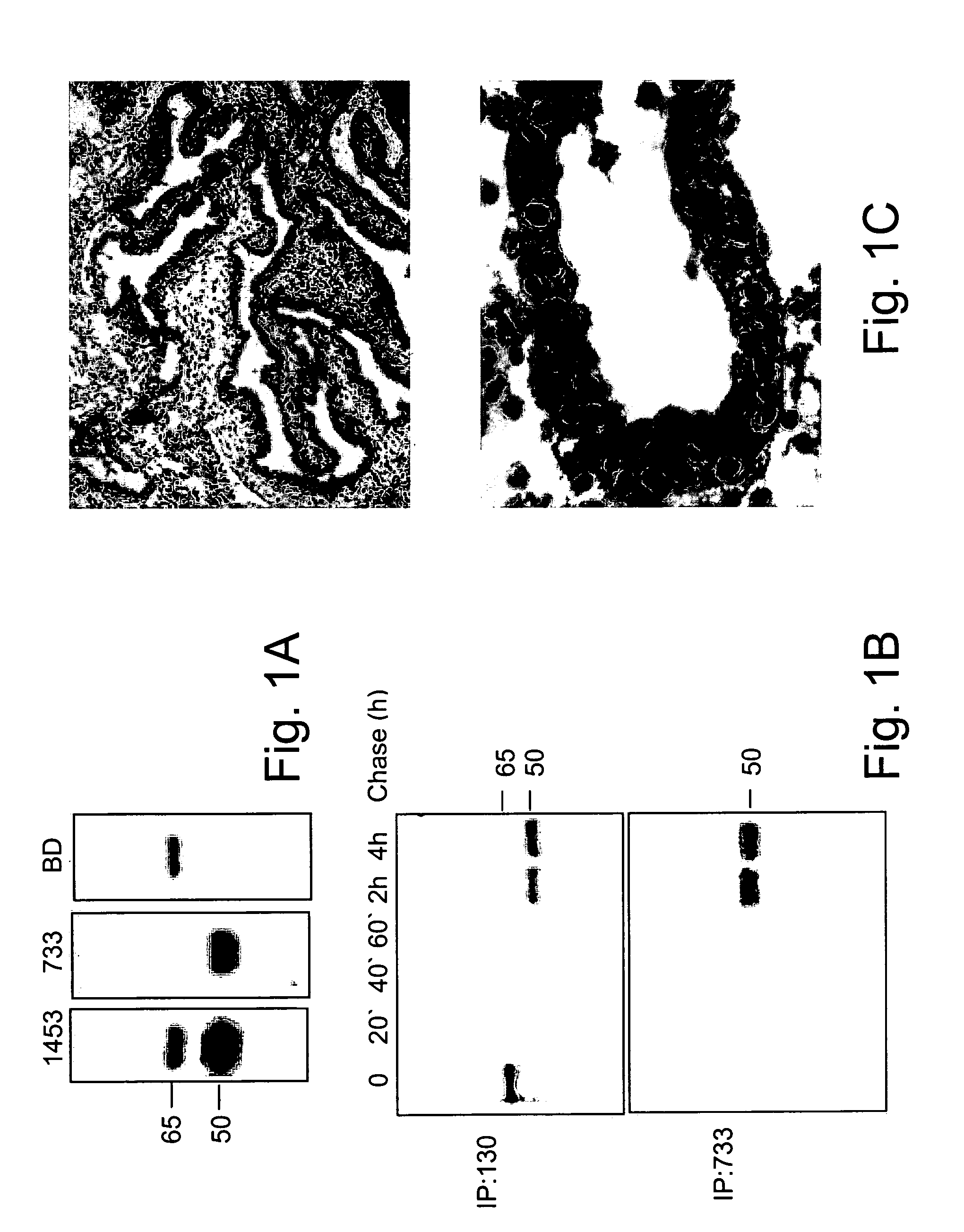 Substances directed against a specific sequence essential for heparanase catalytic activity and uses thereof as heparanase inhibitors