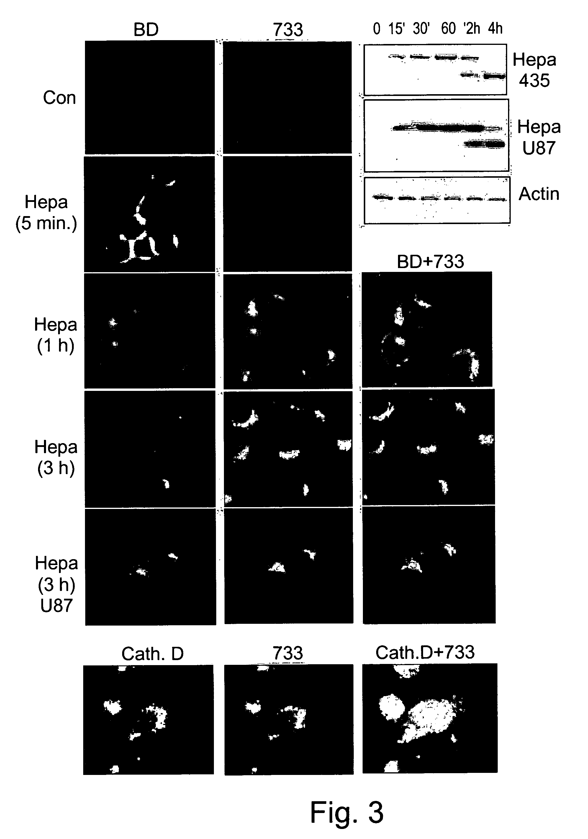 Substances directed against a specific sequence essential for heparanase catalytic activity and uses thereof as heparanase inhibitors