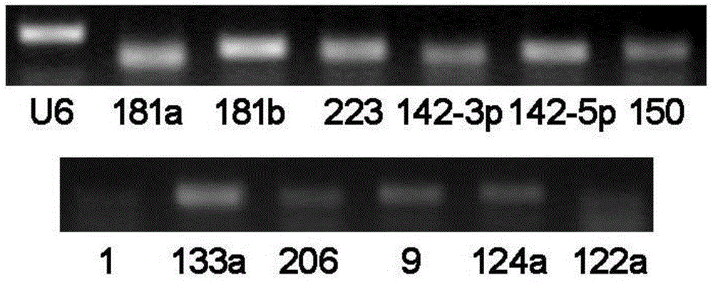 Non-small cell lung cancer marker as well as detection method and application thereof