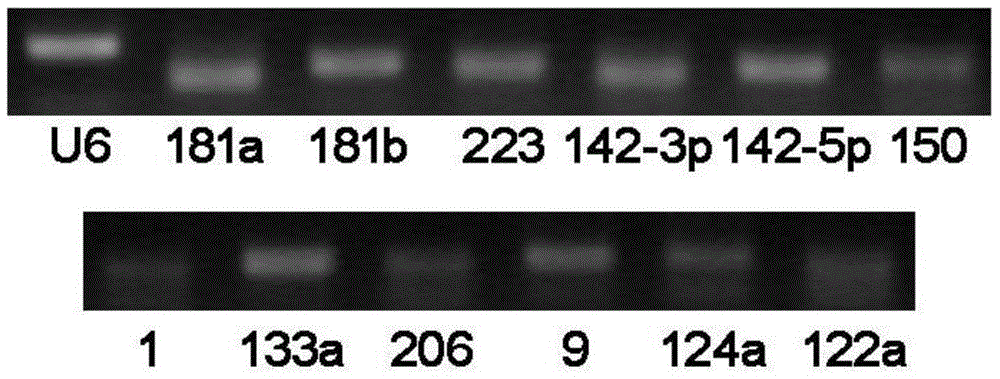 Non-small cell lung cancer marker as well as detection method and application thereof