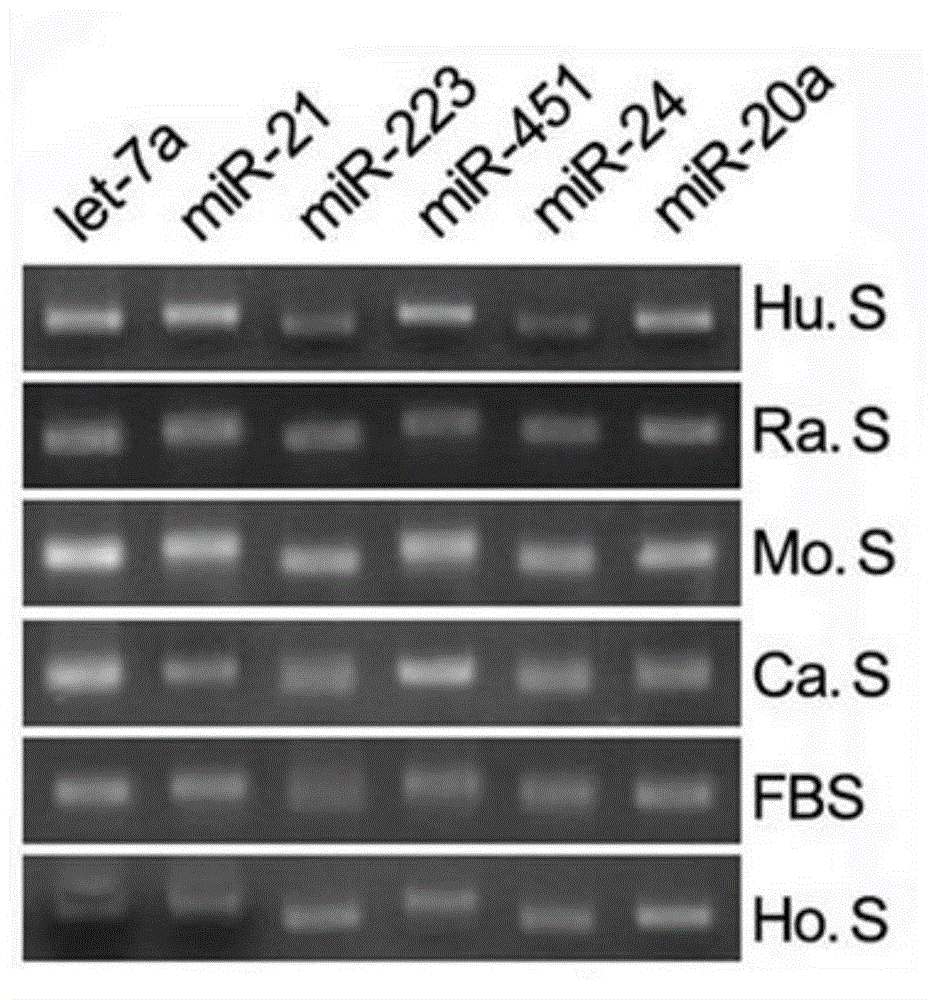 Non-small cell lung cancer marker as well as detection method and application thereof