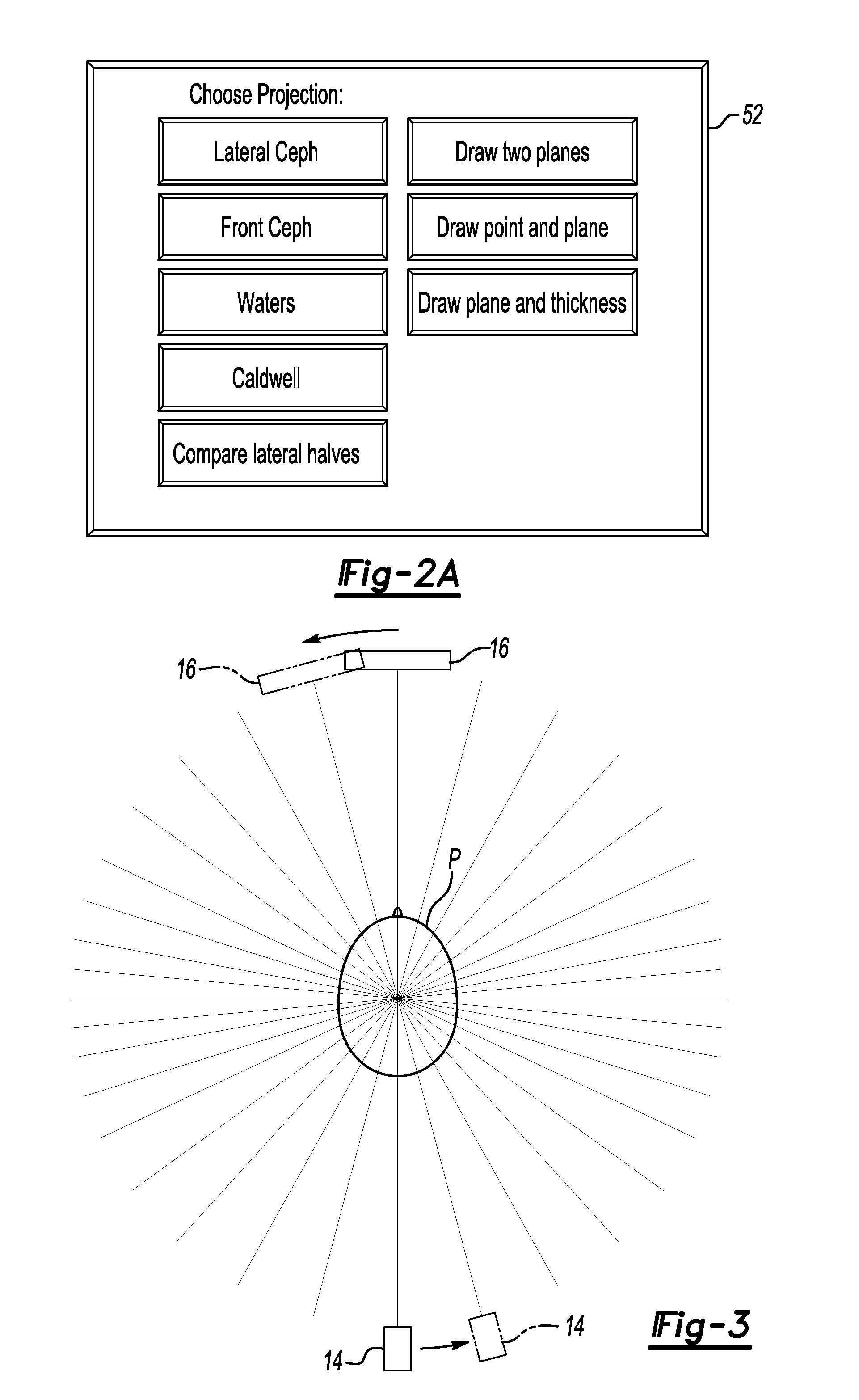 CT system with synthetic view generation