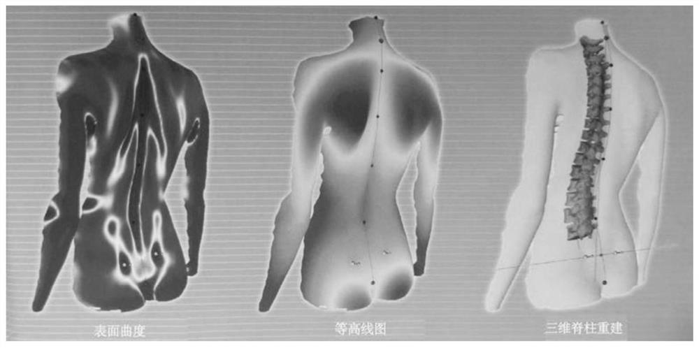 Female weightlifting athlete lumbosacral joint biomechanical analysis method based on numerical simulation