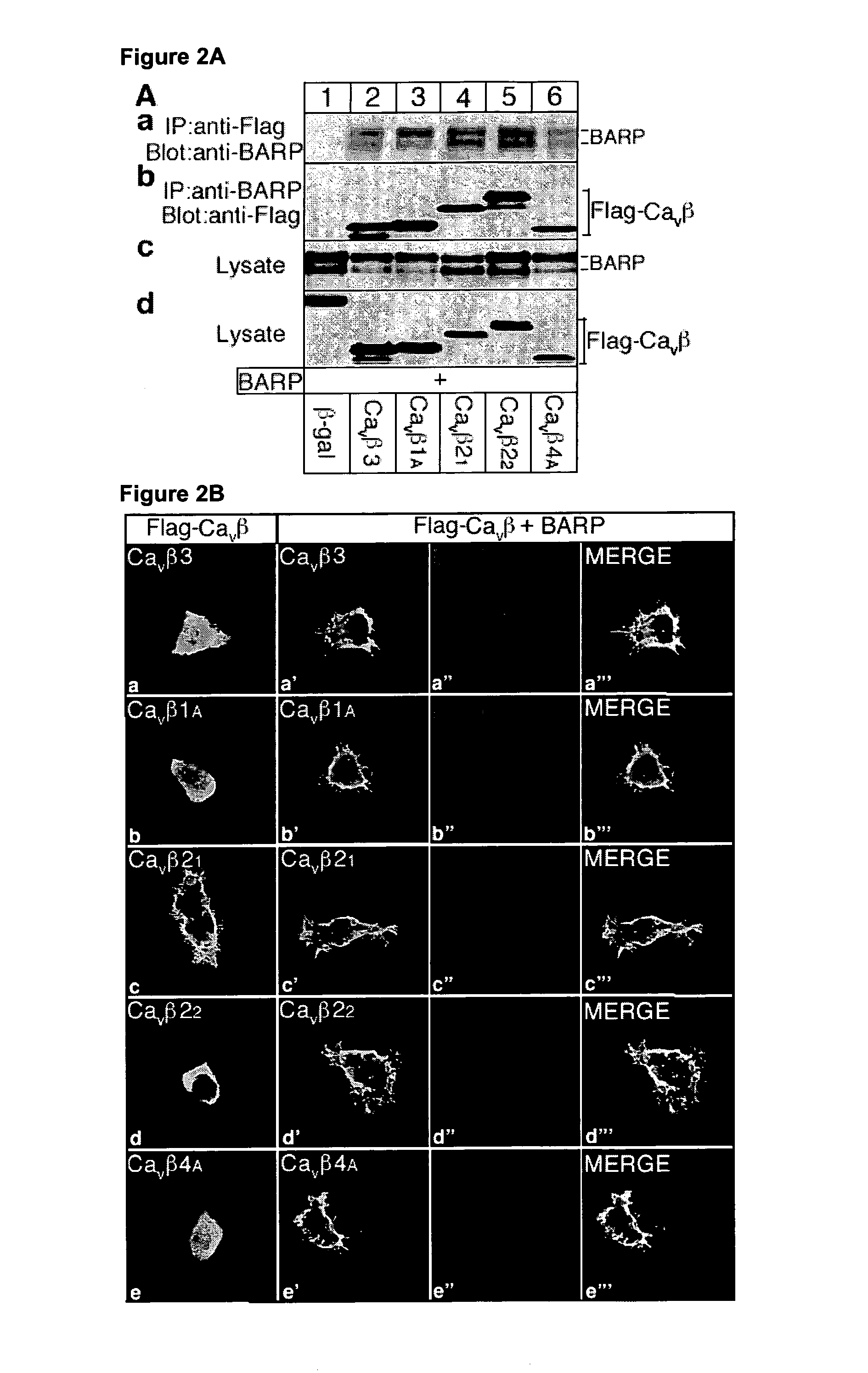 Voltage gated calcium channel β-subunit anchoring regulator protein and uses thereof