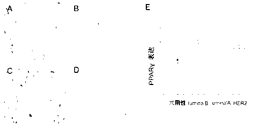 Pharmaceutical composition for treating triple negative breast cancer and application thereof