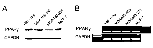 Pharmaceutical composition for treating triple negative breast cancer and application thereof