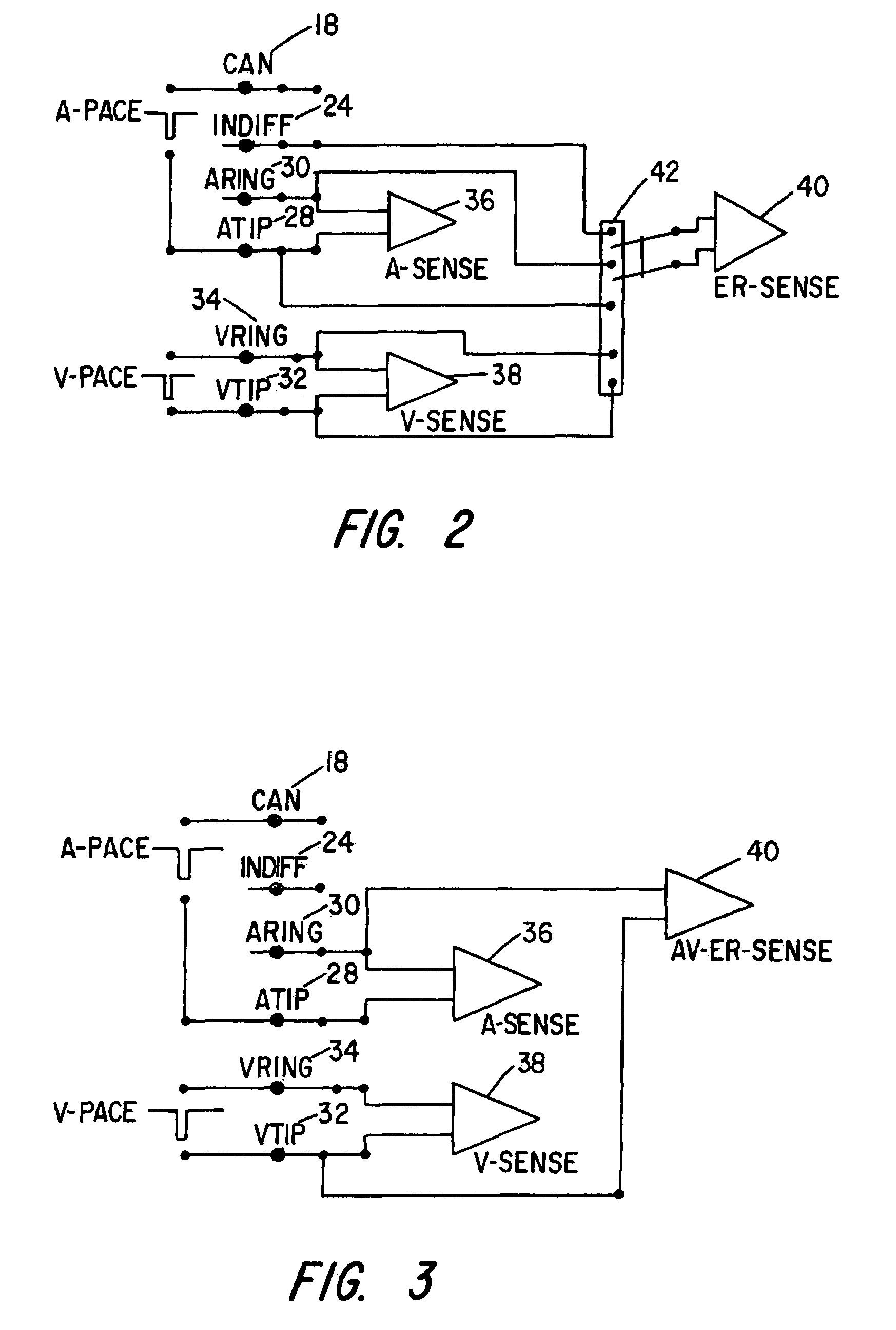 Autocapture pacing/sensing configuration