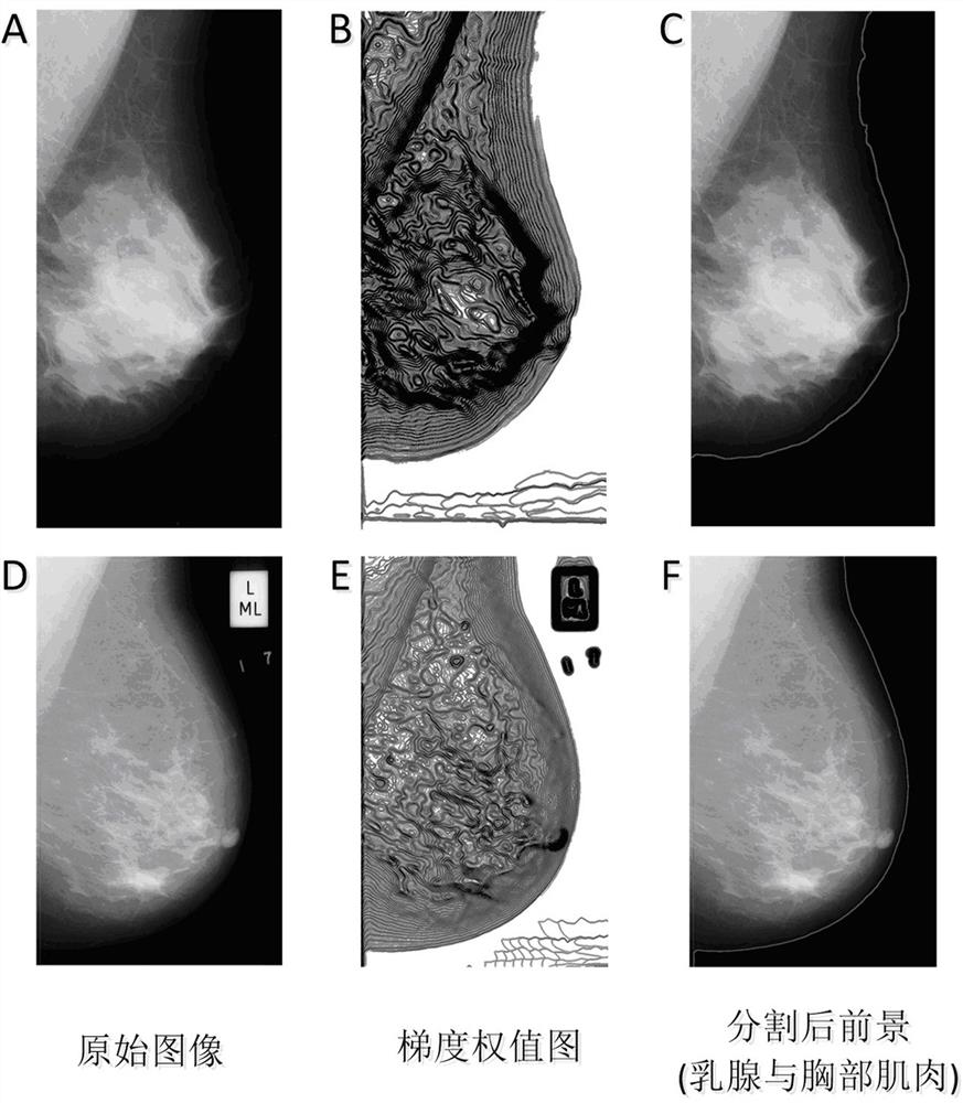 Deep learning classification method for mammography images based on lightweight neural network