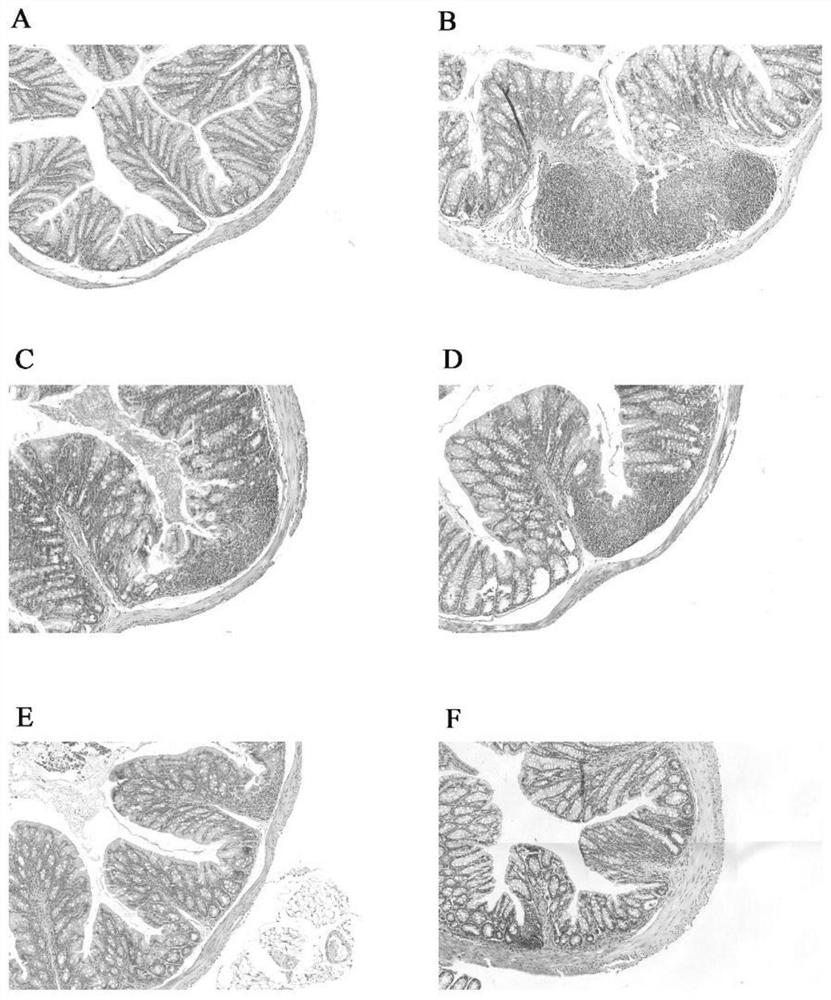 A strain of Lactobacillus fermentum capable of regulating intestinal tight junction proteins and its application