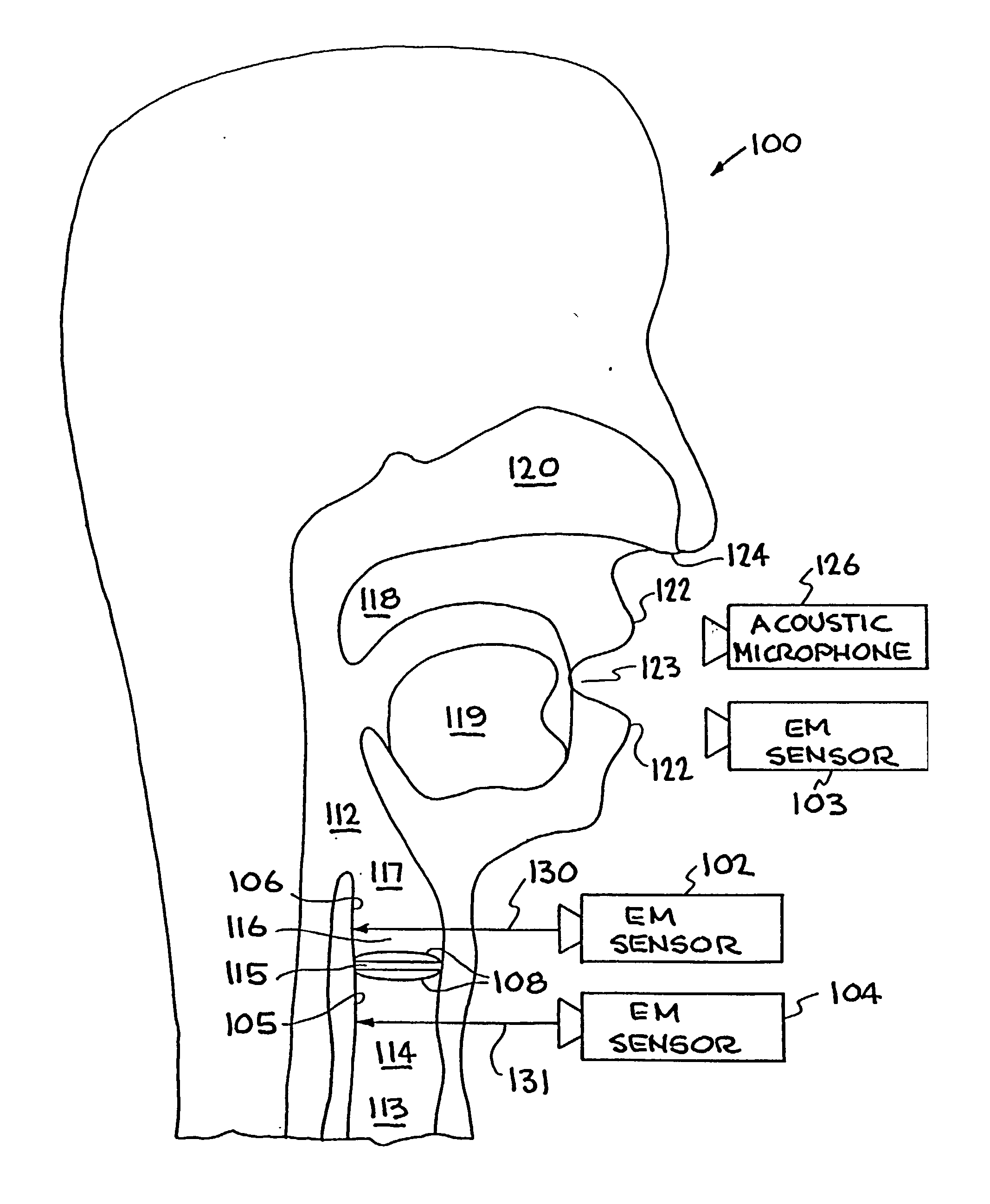 System and method for characterizing voiced excitations of speech and acoustic signals, removing acoustic noise from speech, and synthesizing speech