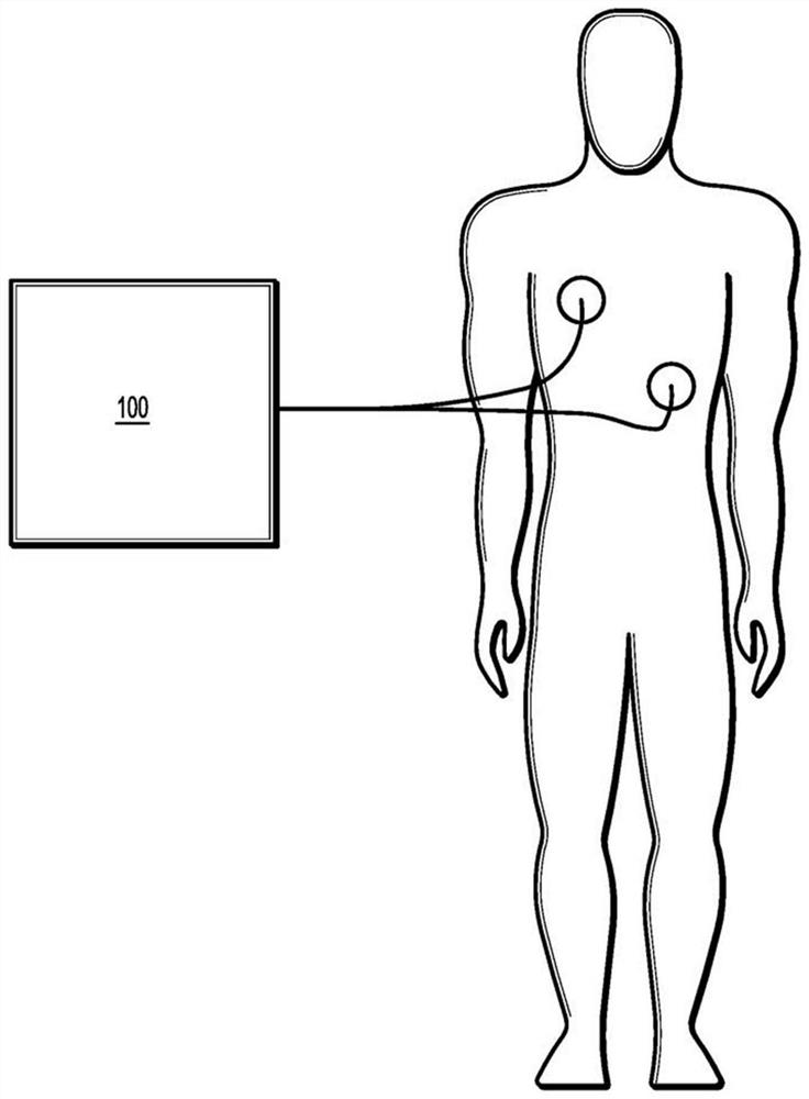 Systems and methods for evaluation of health situation or condition