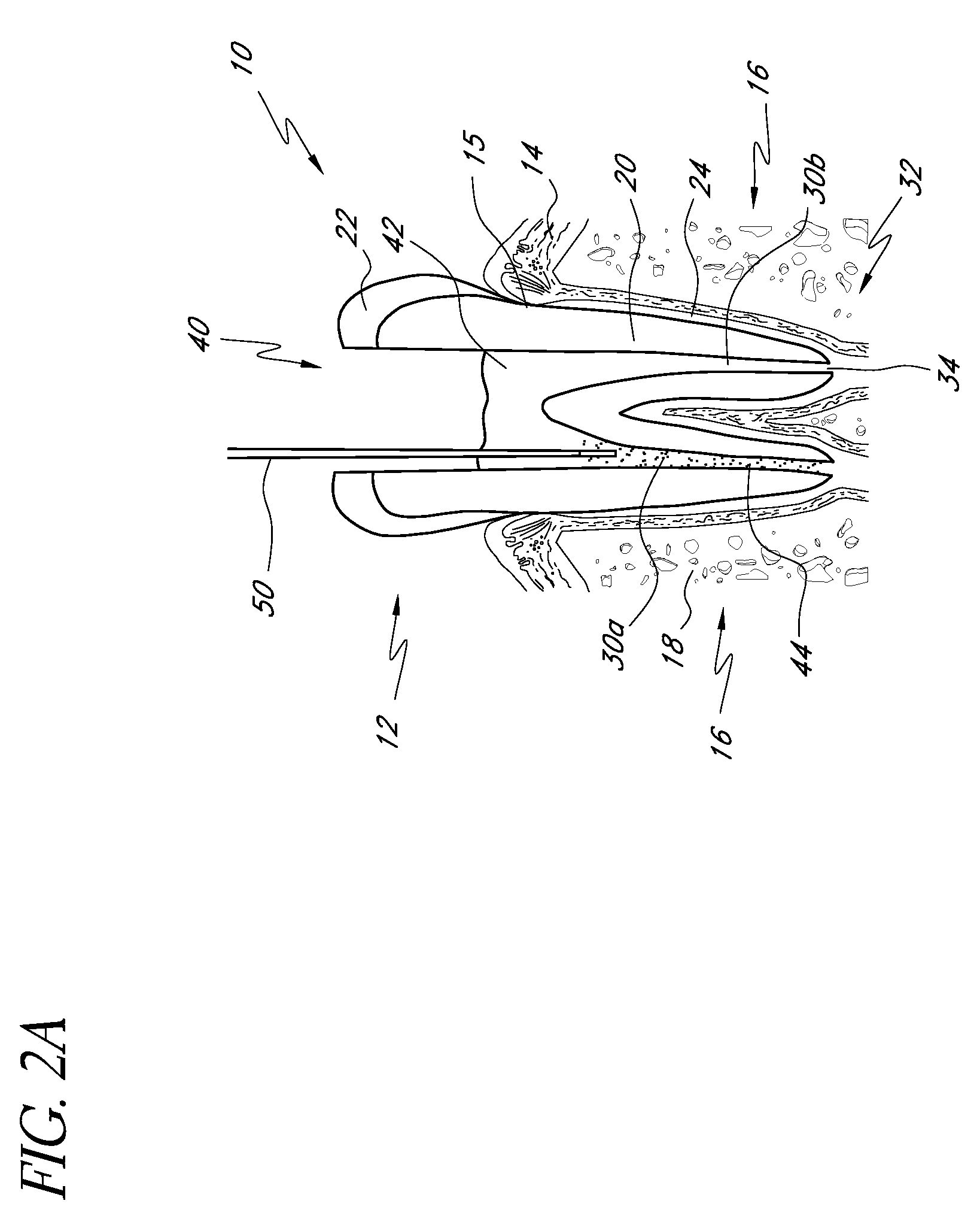 Root canal filling materials and methods