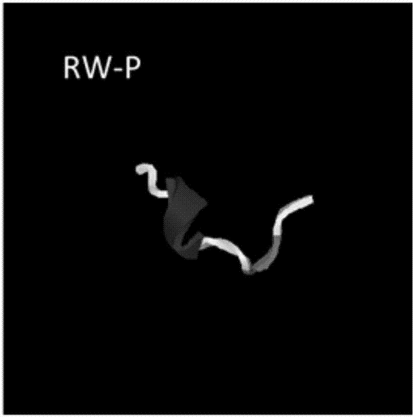 Antibacterial peptide RW-P and preparation method and application thereof