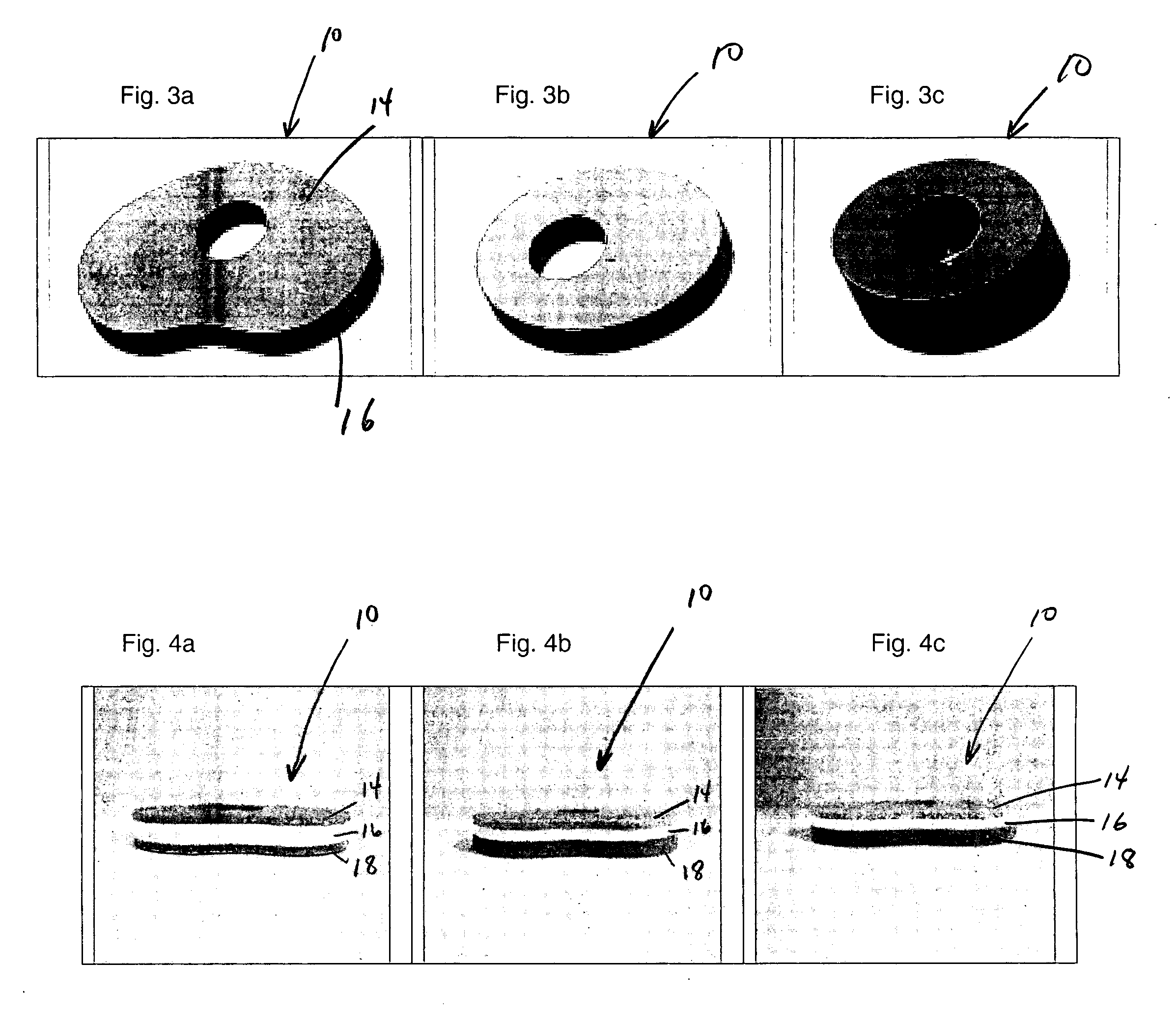 Load relieving wound dressing