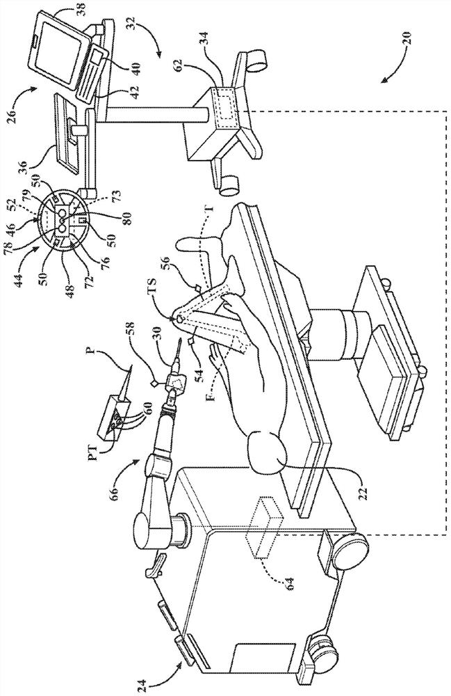 Systems and methods for performing surgery on a patient at a target site defined by virtual objects