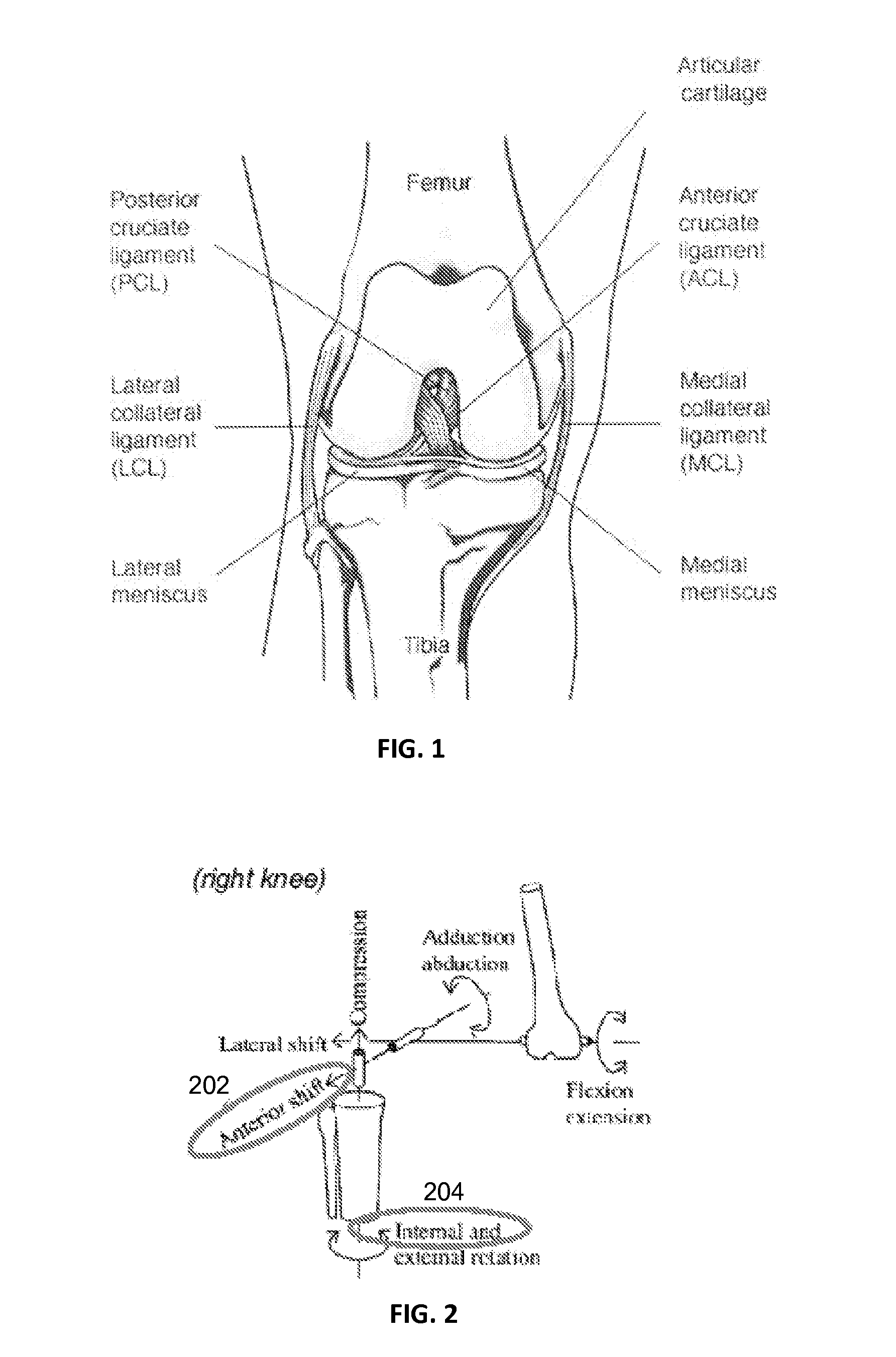 Mechanical pivot shift measurement to evaluate joints