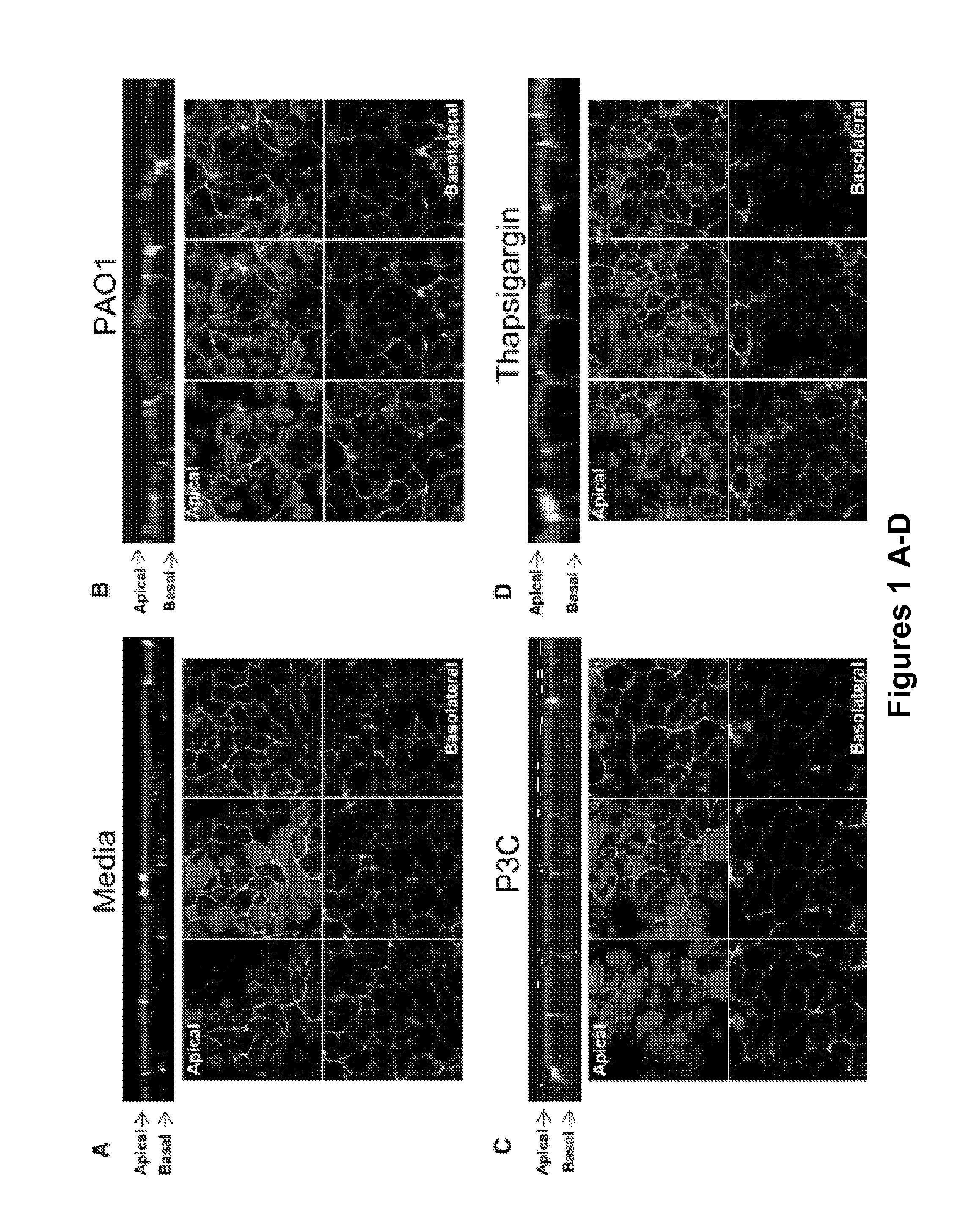 Uses of calpain inhibitors to inhibit inflammation