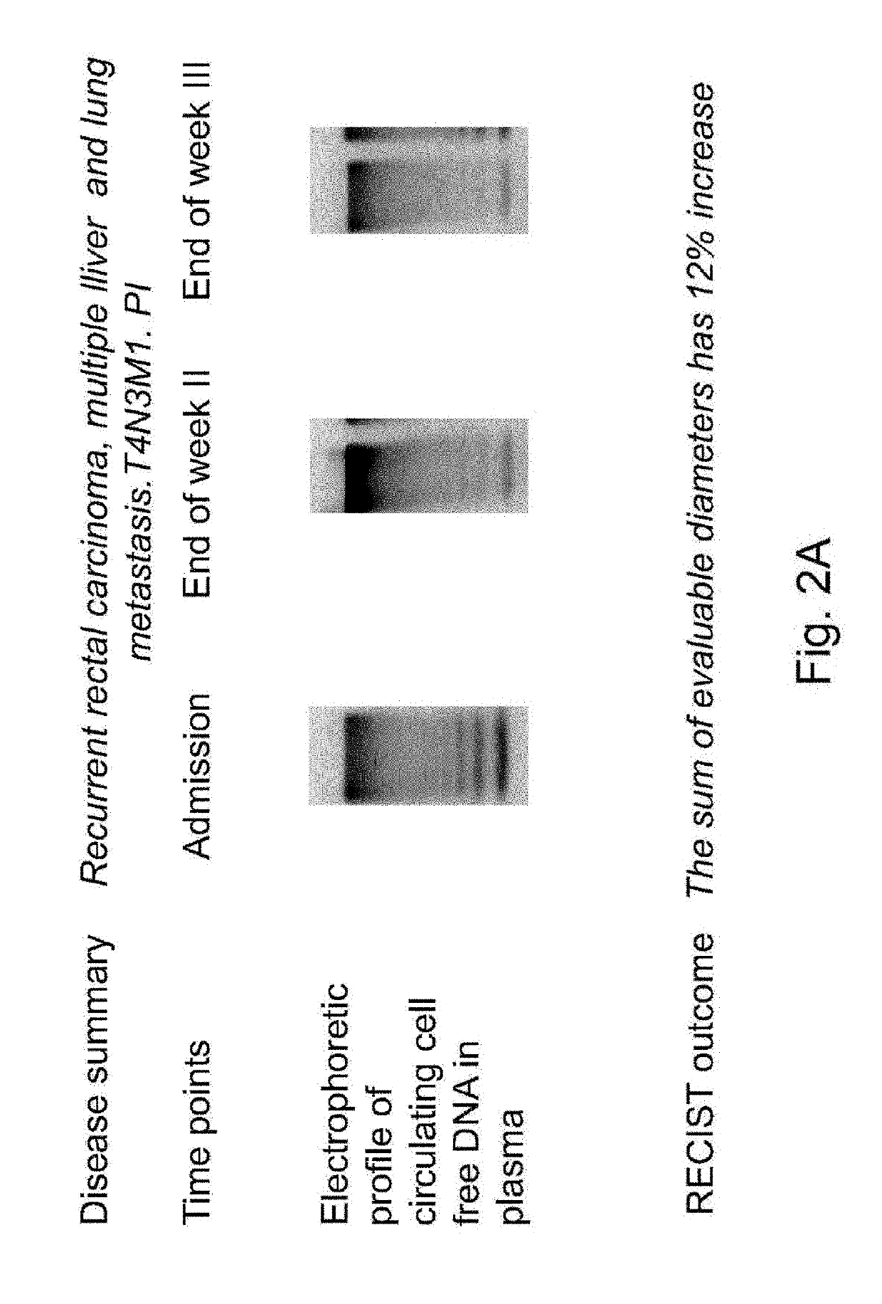 TREATMENT OF DISEASES BY LIVER EXPRESSION OF AN ENZYME WHICH HAS A DEOXYRIBONUCLEASE (DNase) ACTIVITY