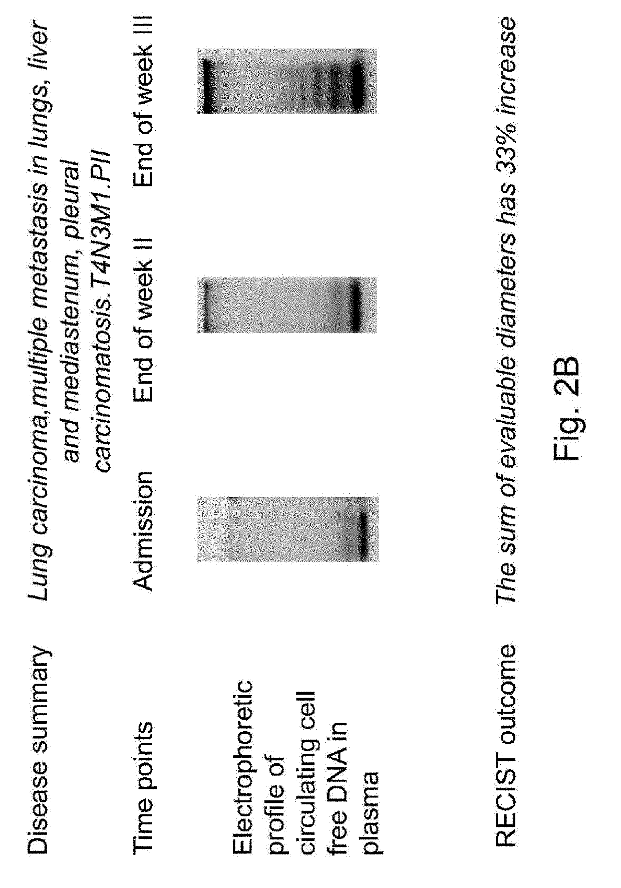 TREATMENT OF DISEASES BY LIVER EXPRESSION OF AN ENZYME WHICH HAS A DEOXYRIBONUCLEASE (DNase) ACTIVITY