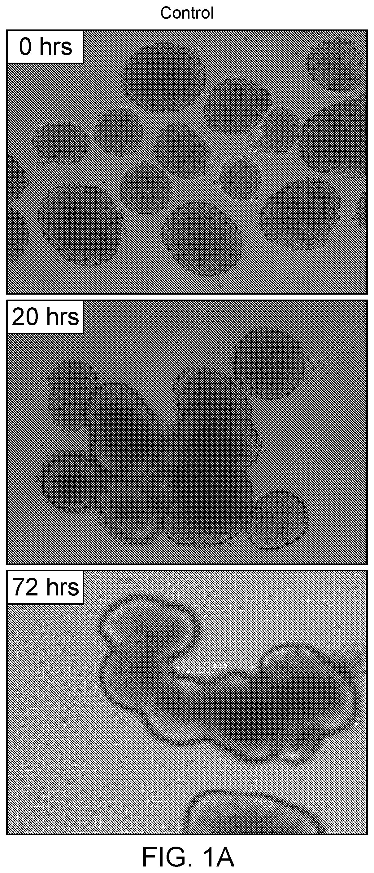 Composition and Methods for Producing Insulin Producing Islet Cells