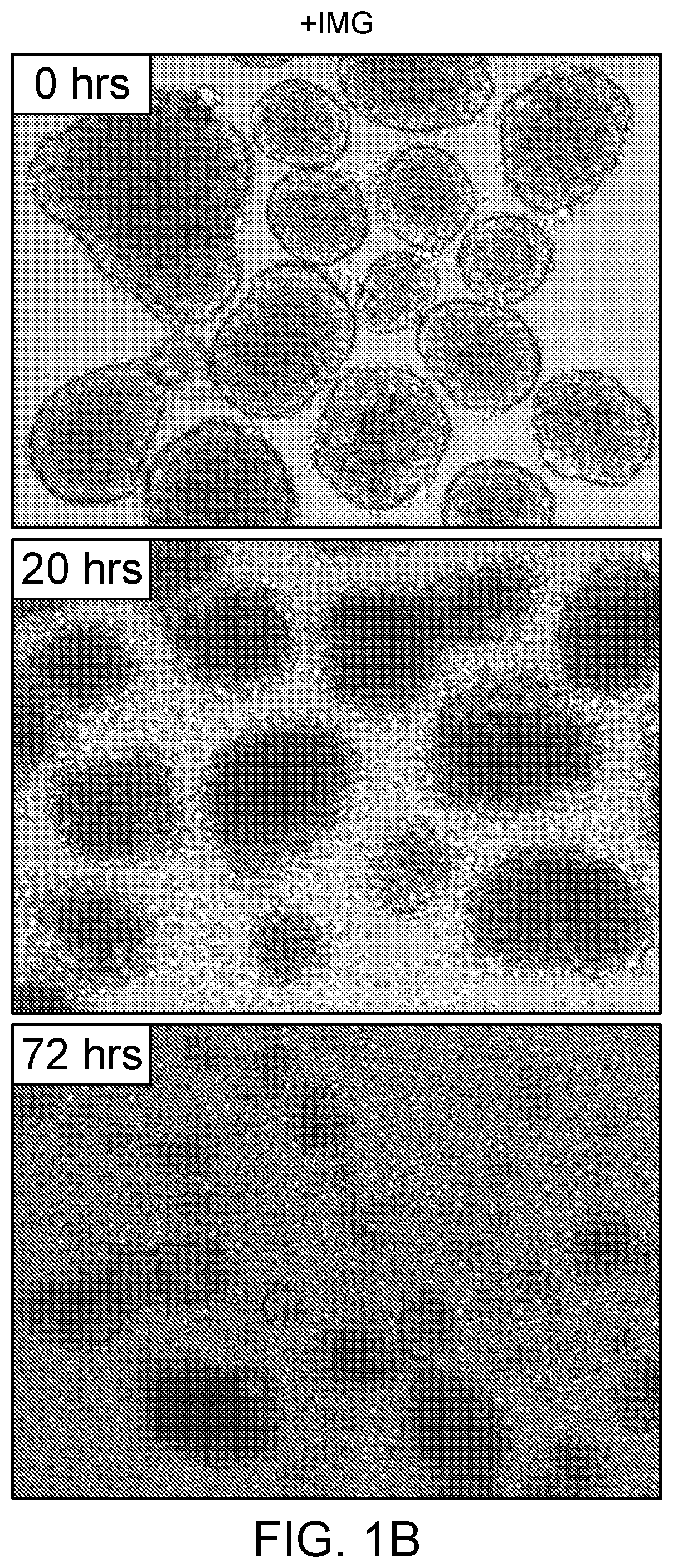 Composition and Methods for Producing Insulin Producing Islet Cells