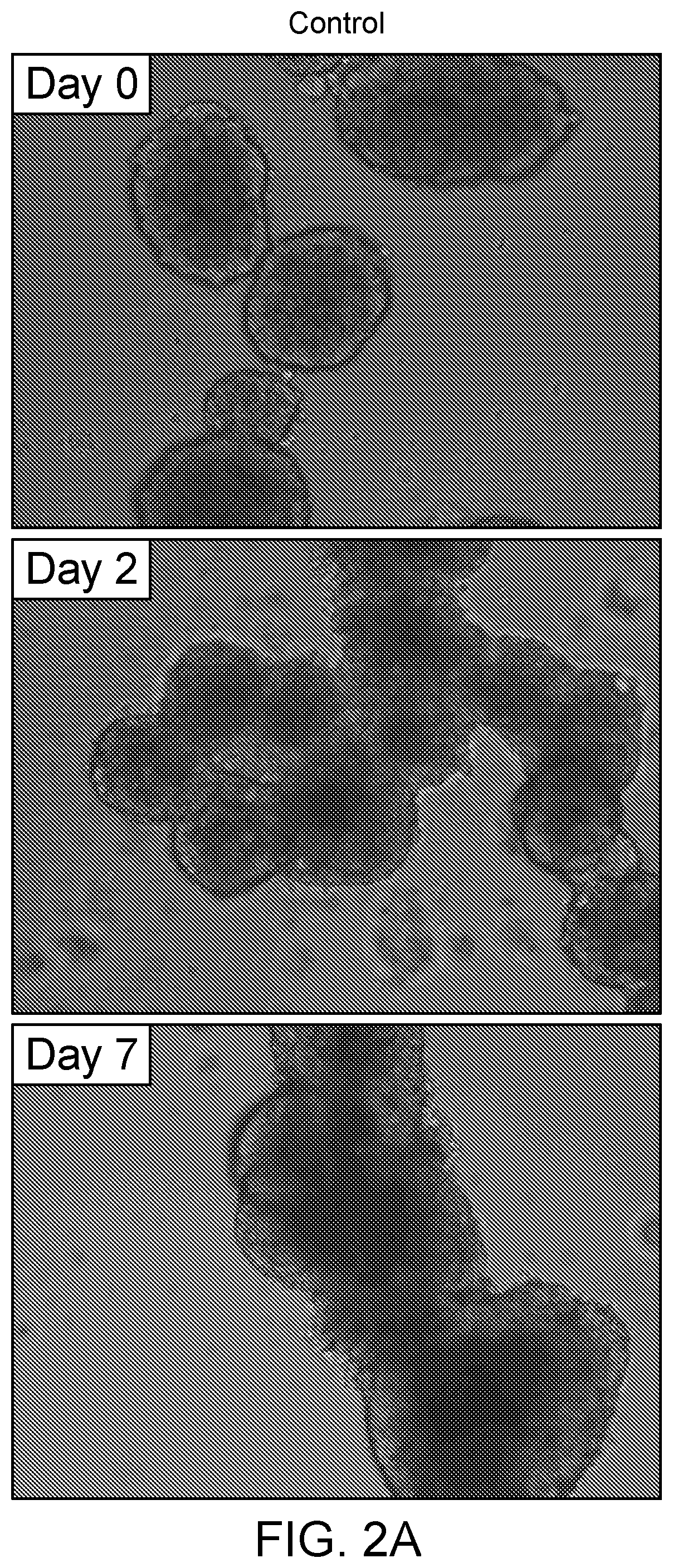 Composition and Methods for Producing Insulin Producing Islet Cells