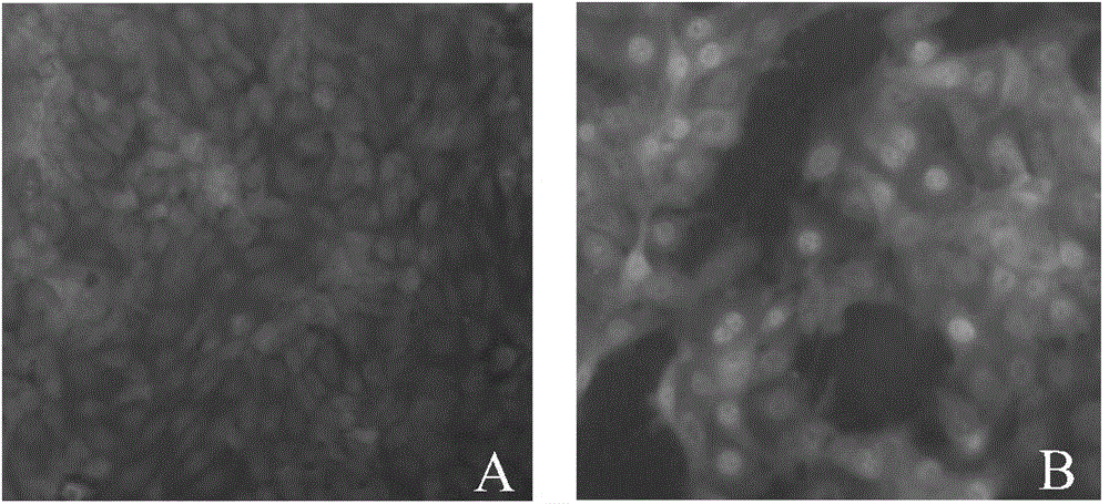 Porcine pseudorabies virus strain, inactivated vaccine prepared from porcine pseudorabies virus strain and application of porcine pseudorabies virus strain