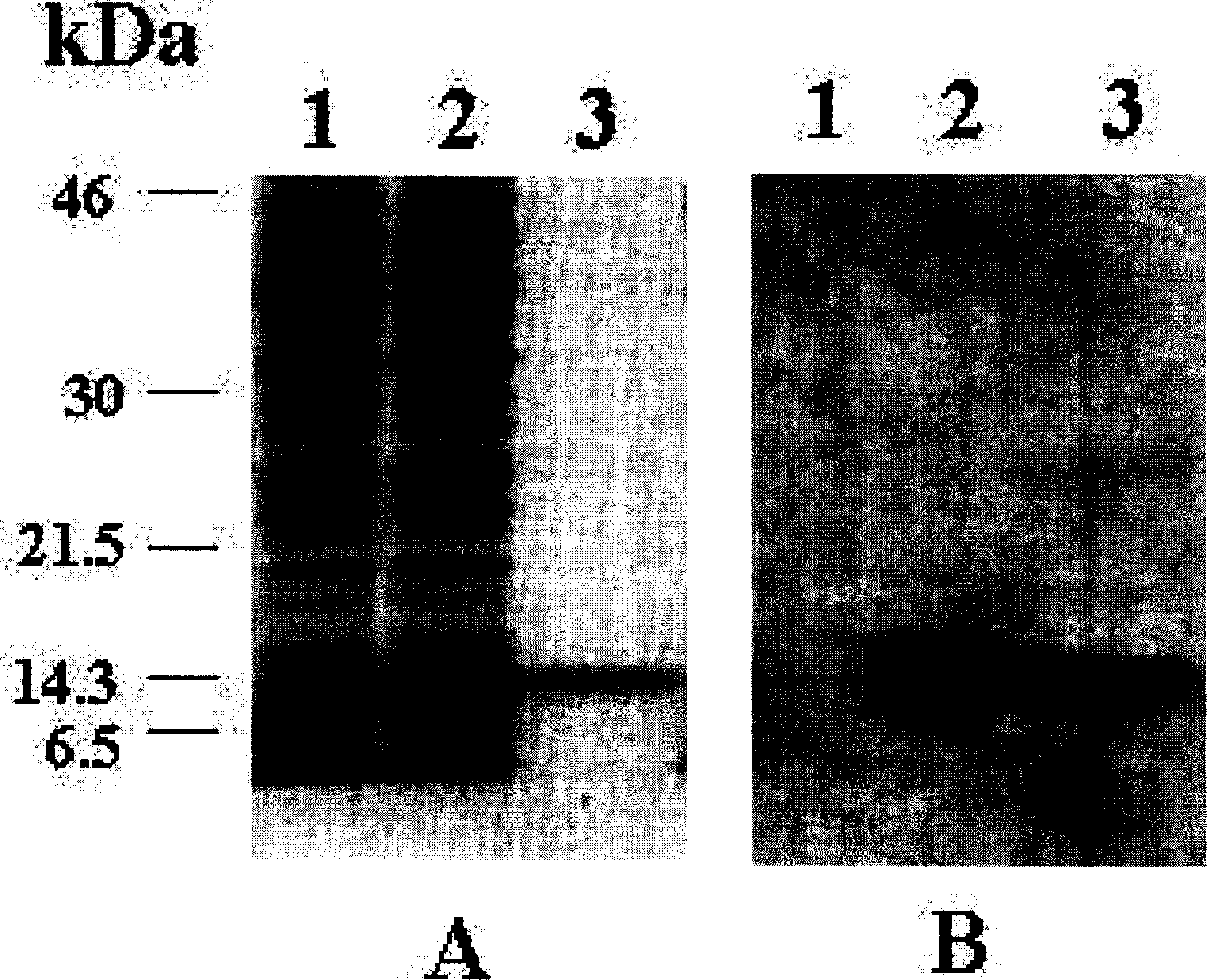 Human profibrinolysin kringle 5 deletion mutation recombinant polypeptide