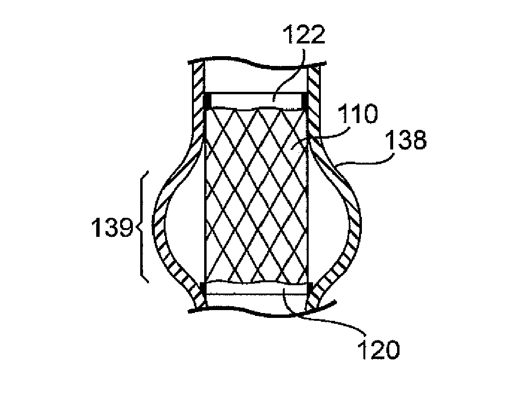 Prosthetic Cardiac Valve from Pericardium Material and Methods of Making Same