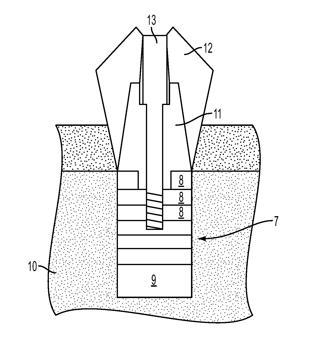 System and method for prevention and treatment of peri-implant infection