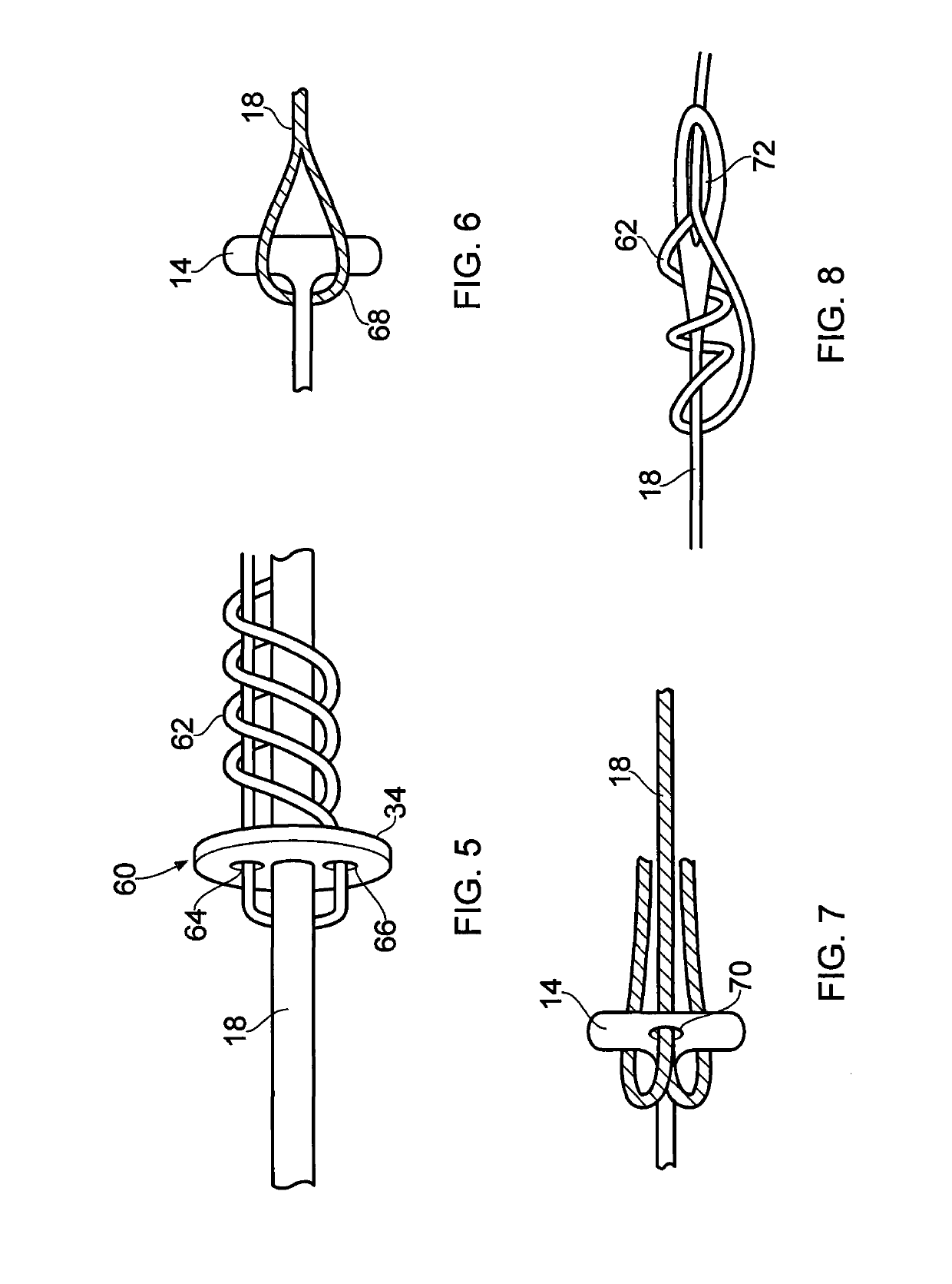 Ligament assembly