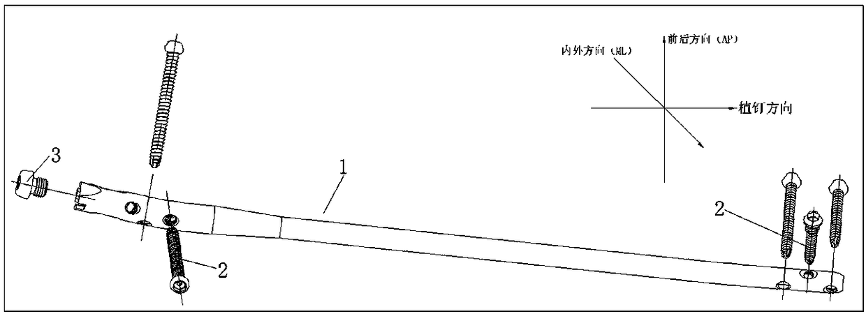 Improved interlocking tibia intramedullary nail