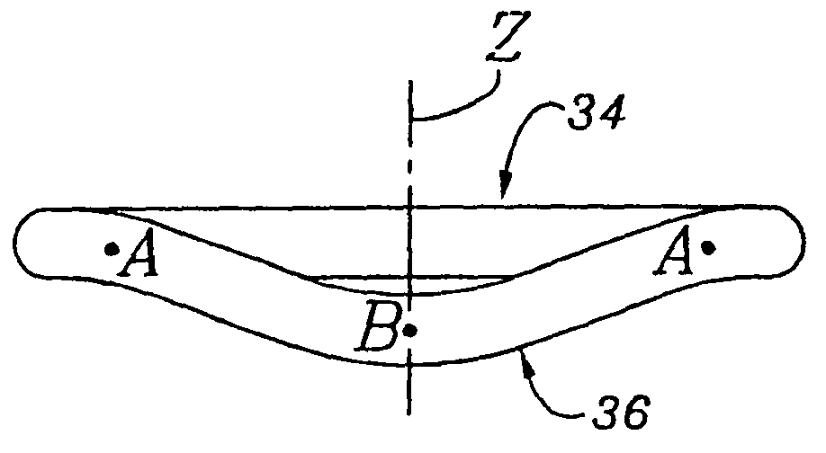 Annuloplasty ring for ischemic mitral valve insuffuciency