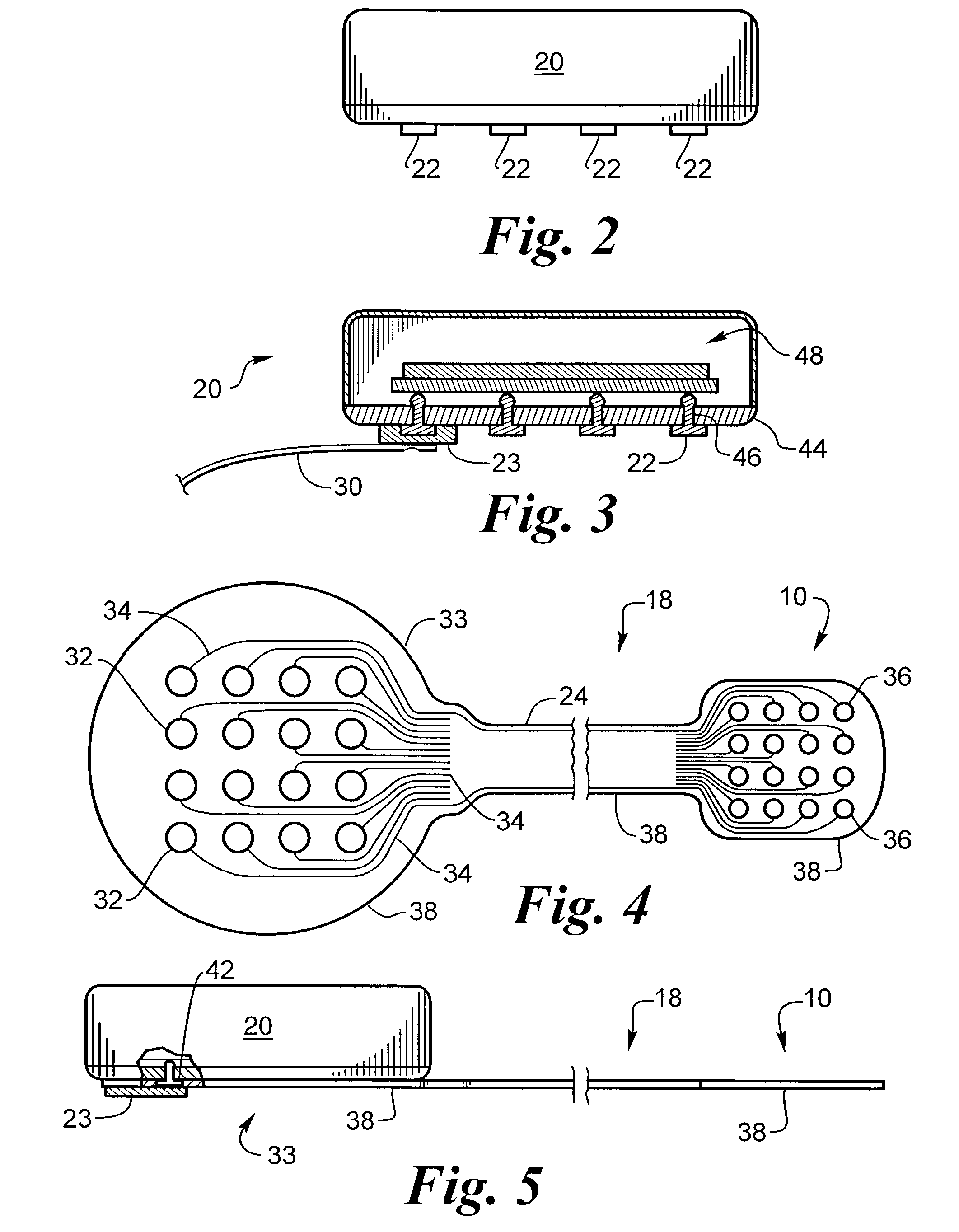 Biocompatible bonding method and electronics package suitable for implantation