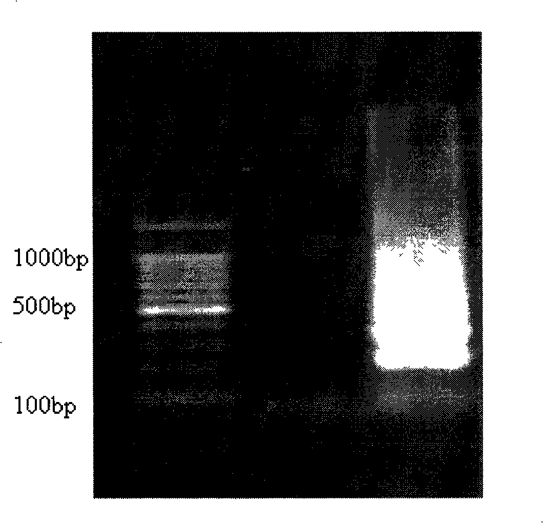 Reagent kit and method for detection of enterocolitis yersinia genus with ring mediated isothermality amplification method