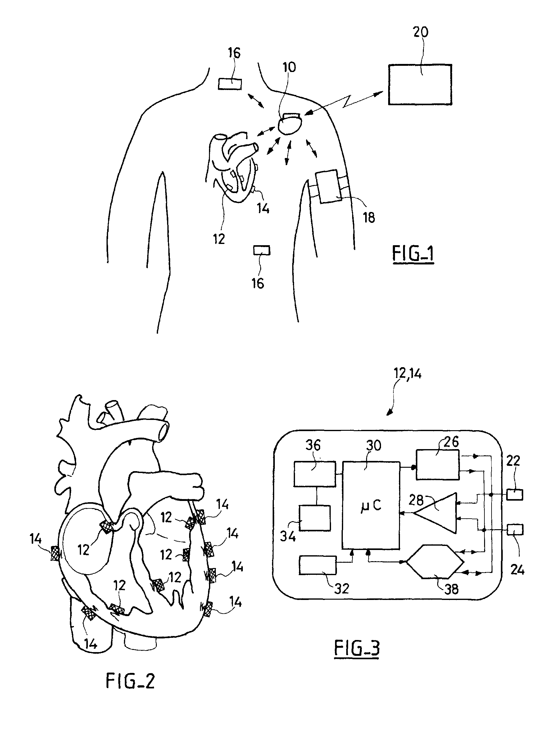 System, methods and apparatus for waking an autonomous active implantable medical device communicating by pulses transmitted through the interstitial tissues of the body