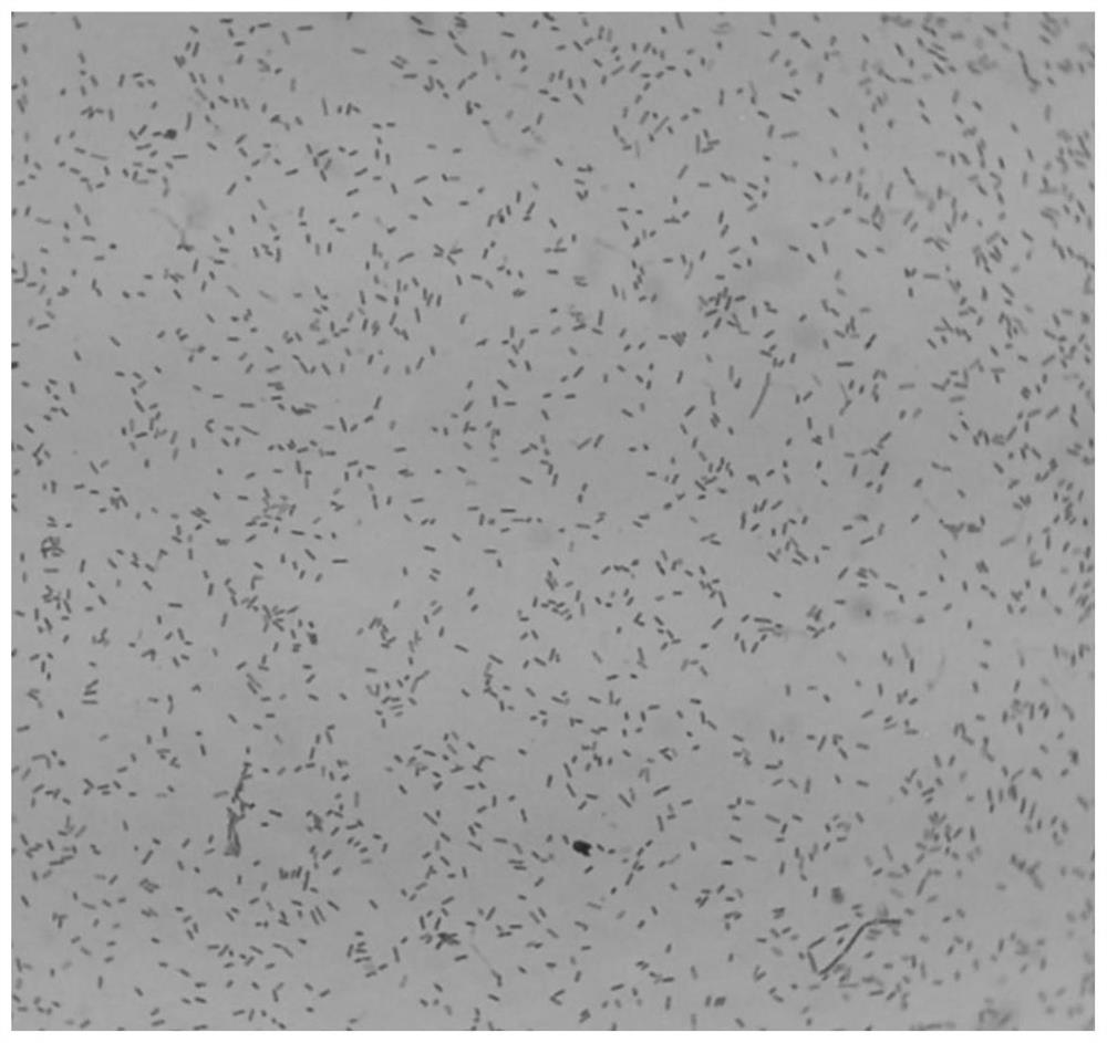 Application of combined medication of bacteroides fragilis and PD-1 and PD-L1 antibodies in treatment of respiratory system tumors