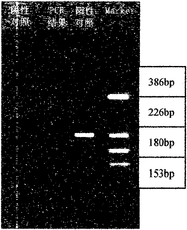 Rapid detection kit of legionella bacteria and detection method thereof