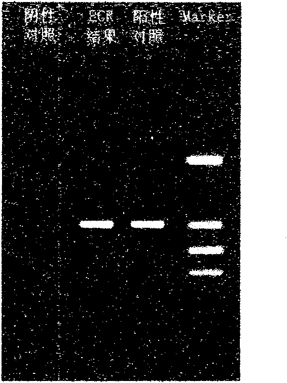 Rapid detection kit of legionella bacteria and detection method thereof