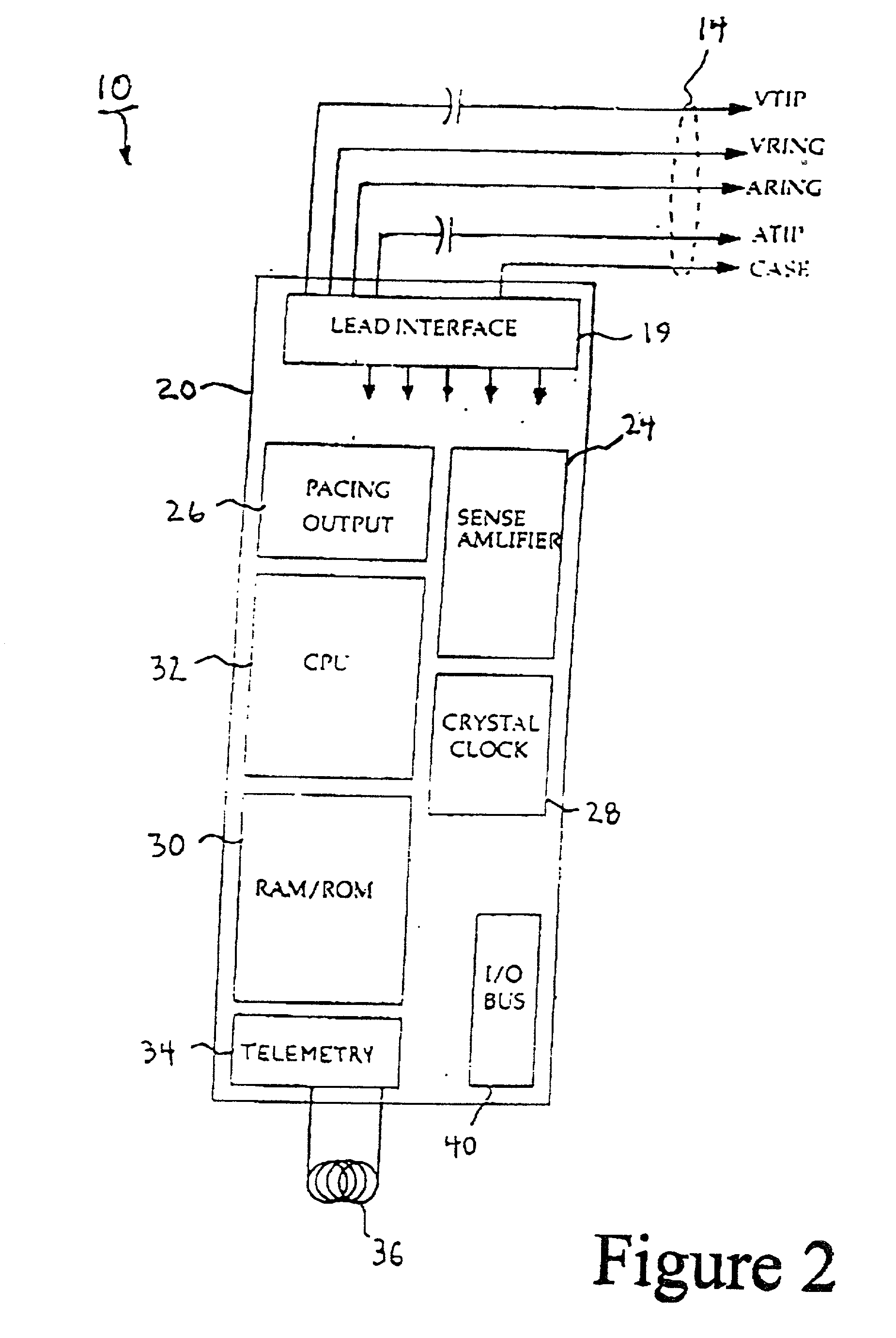 Method and apparatus for displaying information retrieved from an implanted medical device