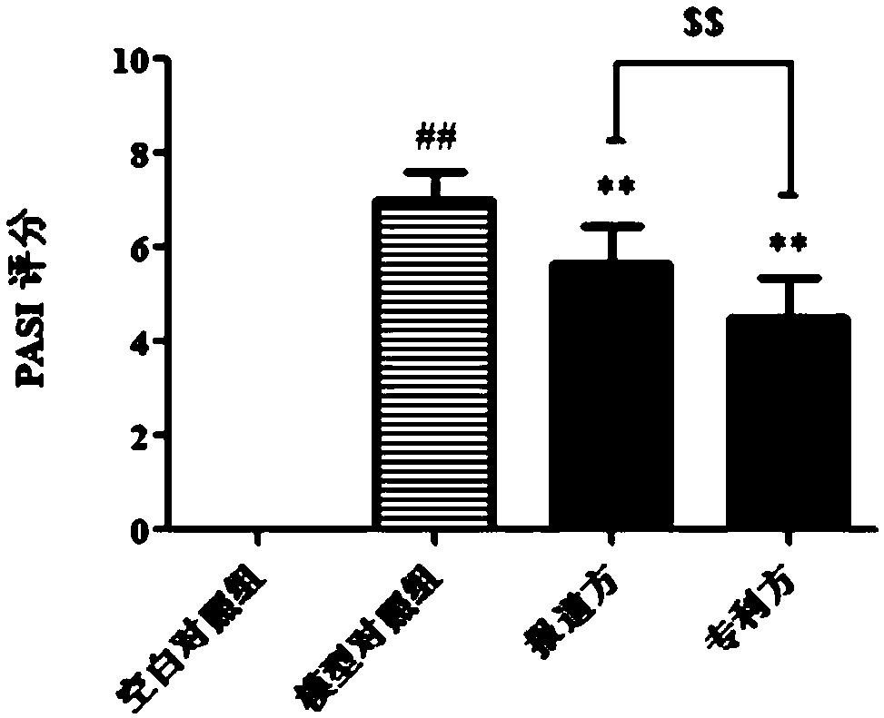 Medicine for external application for treating psoriasis