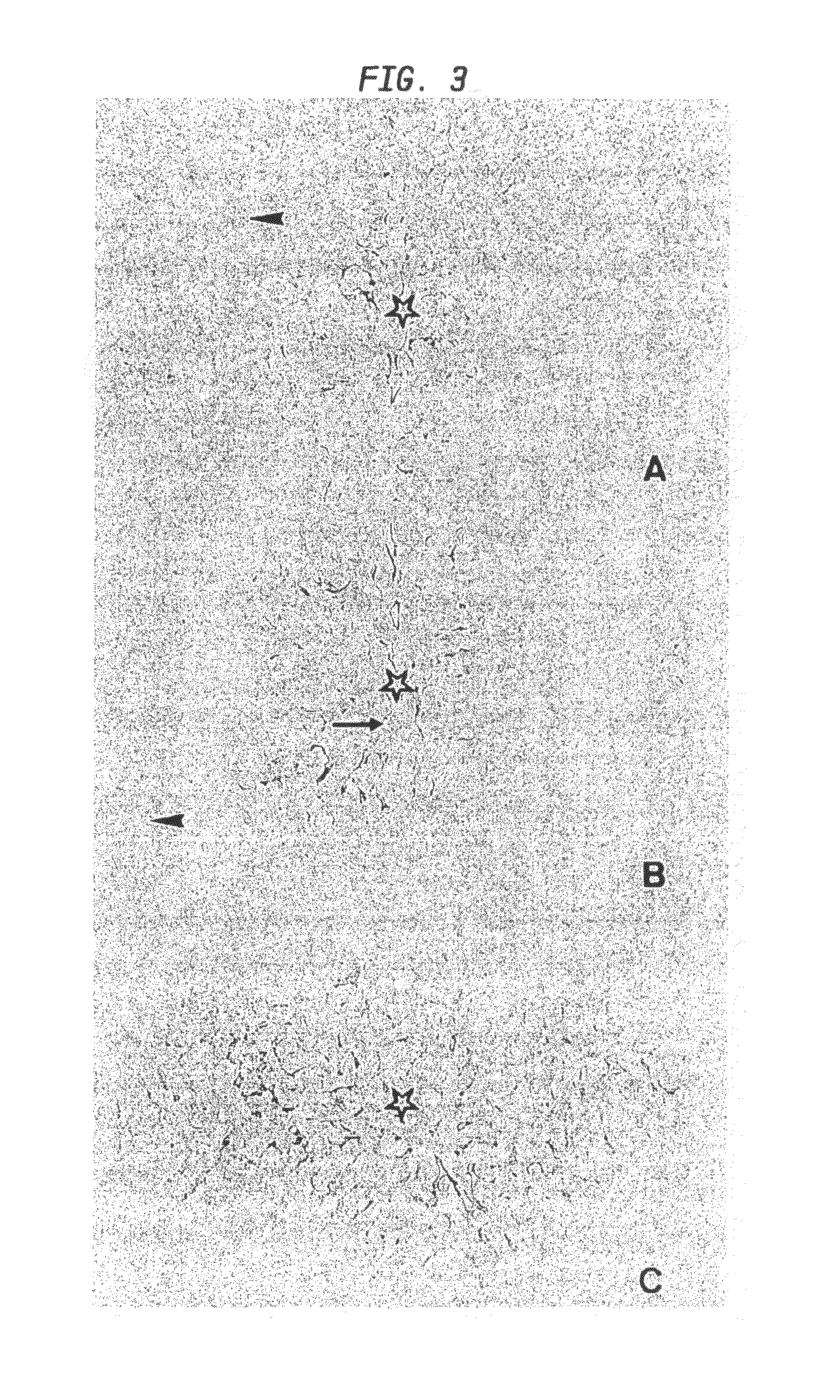 Diagnostic methods for diseases by screening for hepcidin in human or animal tissues, blood or body fluids; monoclonal antibodies specific to human hepcidin and associated uses therefor